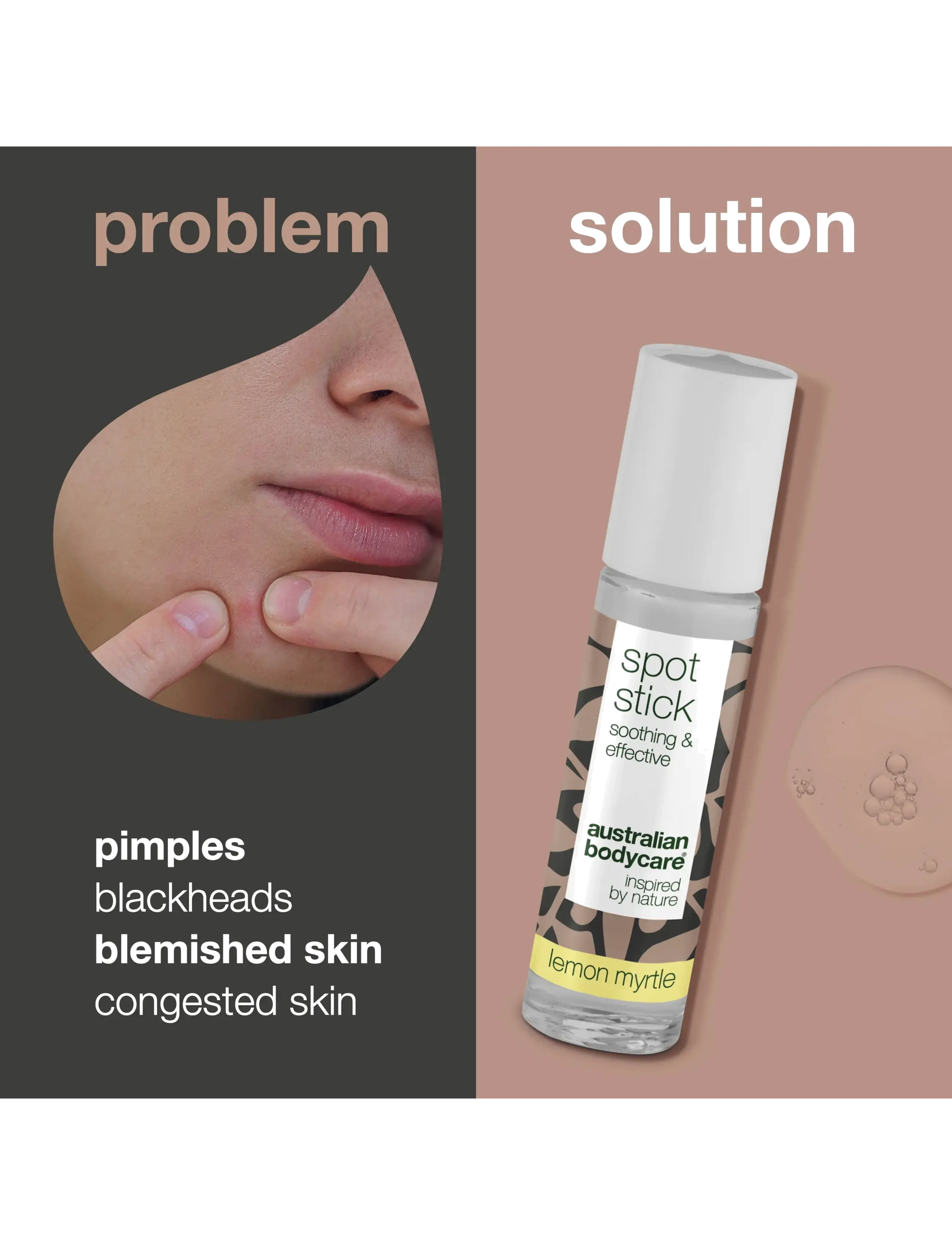 Australian Bodycare - Spot Stick for pimples & blackheads - Lemon Myrtle - 9 ml - spotbehandlinger - no color - 2