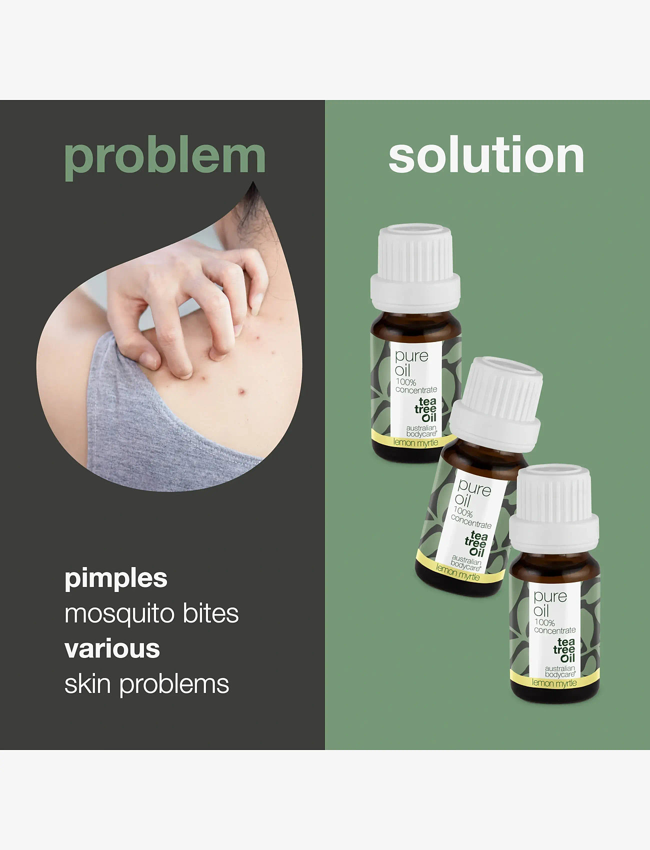 Australian Bodycare - Pure Tea Tree Oil Lemon Myrtle 10 ml - rejsestørrelser & kits  - no color - 2