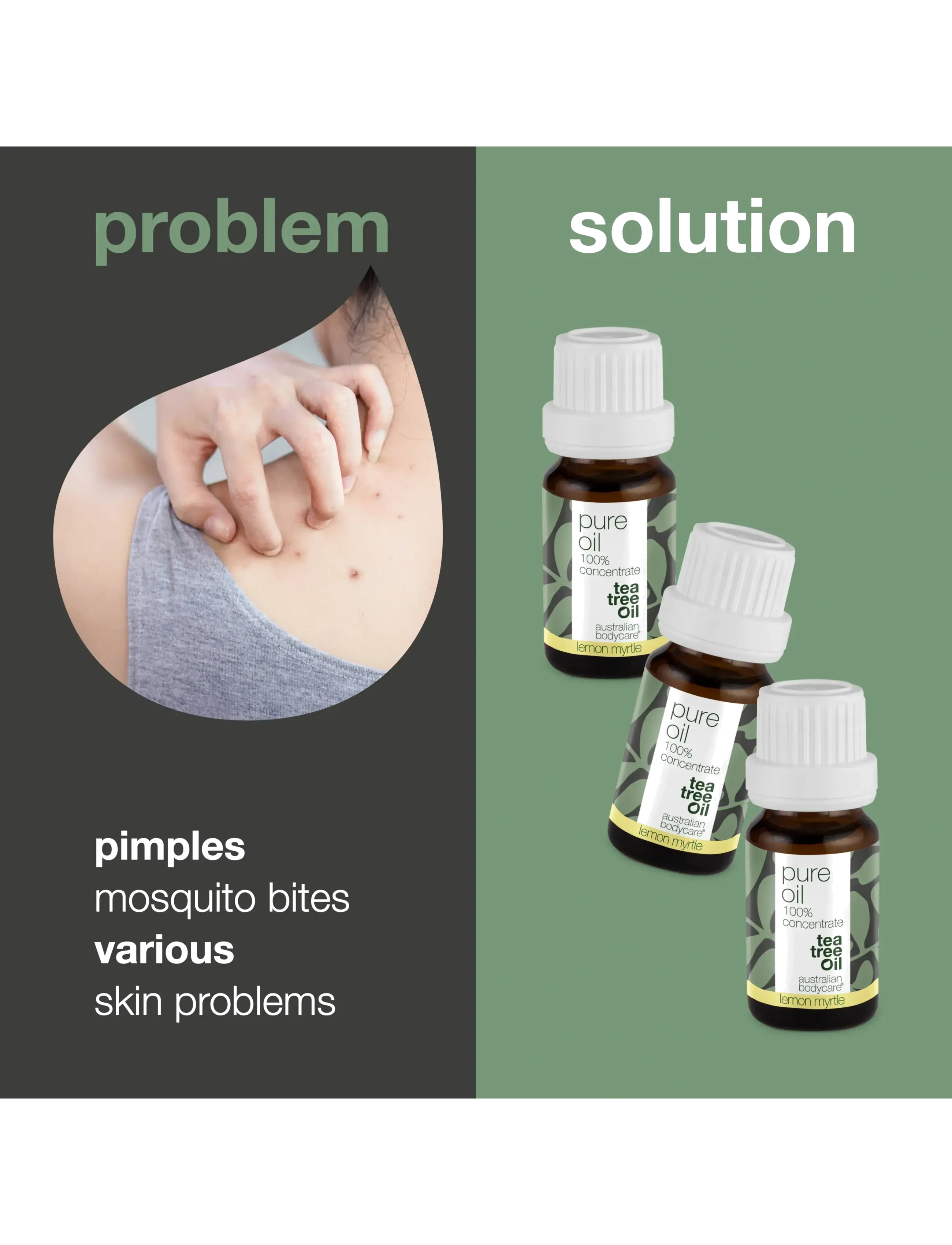 Australian Bodycare - Pure Tea Tree Oil Lemon Myrtle 10 ml - rejsestørrelser & kits  - no color - 2