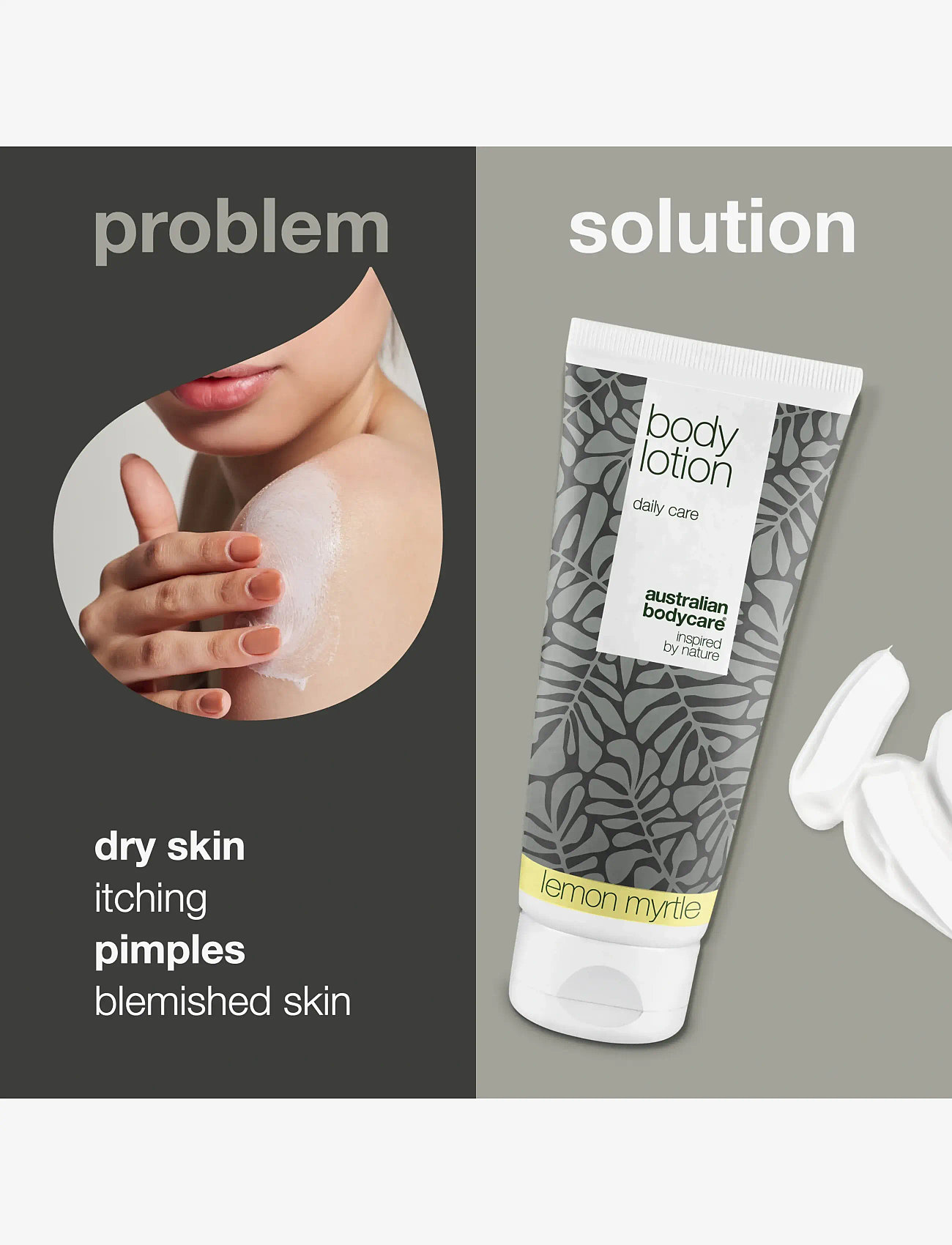 Australian Bodycare - Body Lotion for dry skin & pimples - Lemon Myrtle - 200ml - kreemid - no color - 2