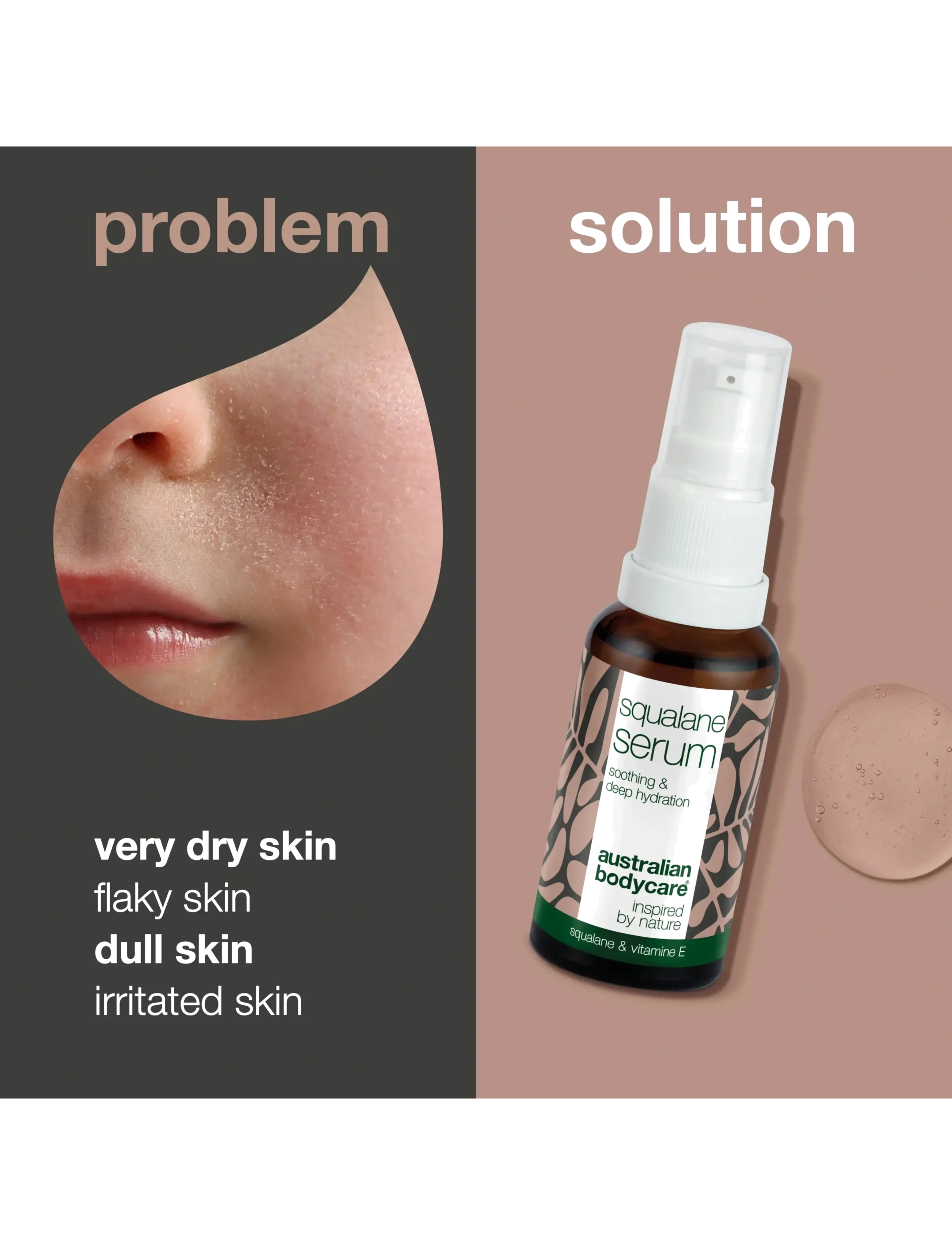 Australian Bodycare - Squalane Serum for very dry skin - 30 ml - ansigspleje - no color - 2