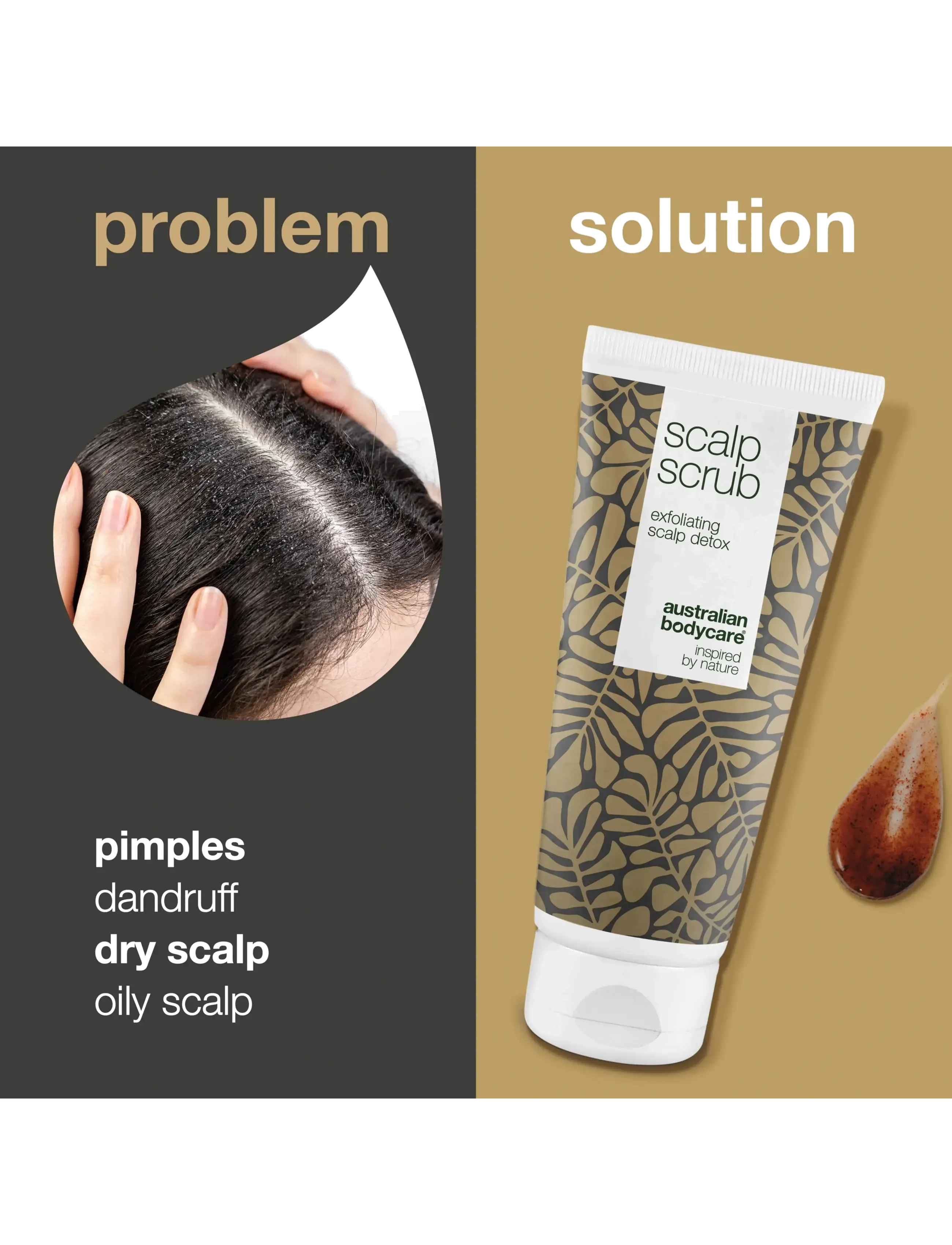 Australian Bodycare - Scalp Scrub 200 ml - hårplejeprodukter - clear - 1