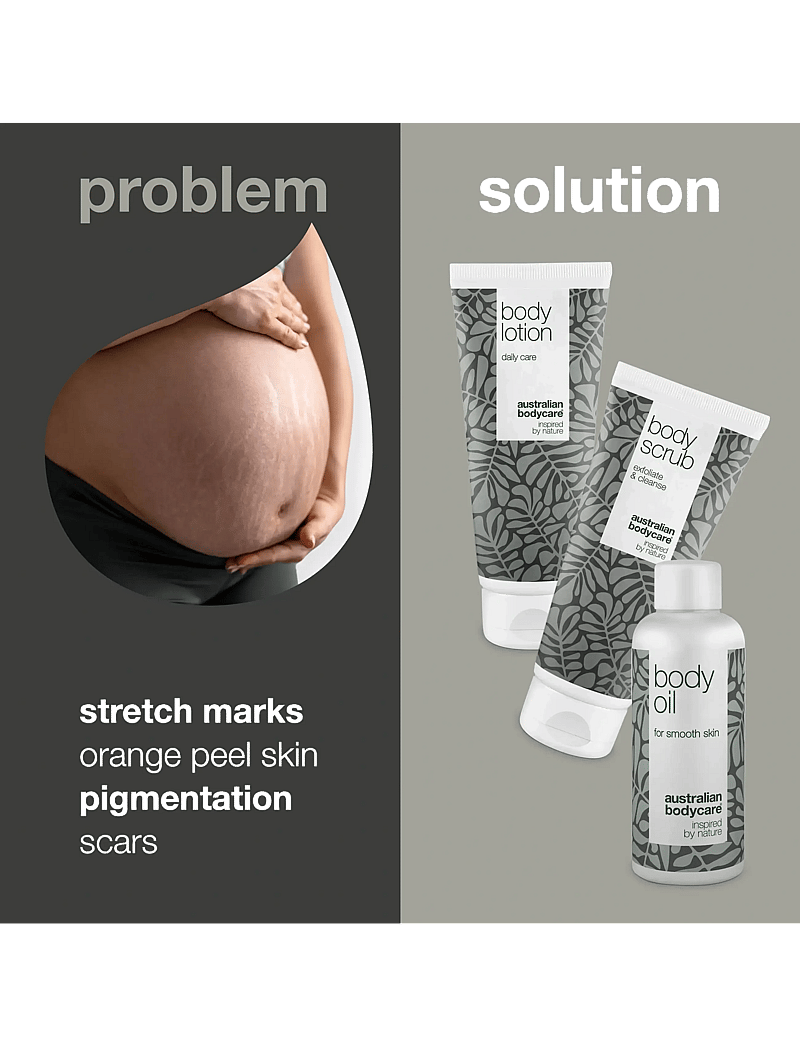 Australian Bodycare - Kit for daily care of stretch marks - giftset - tea tree oil - 1