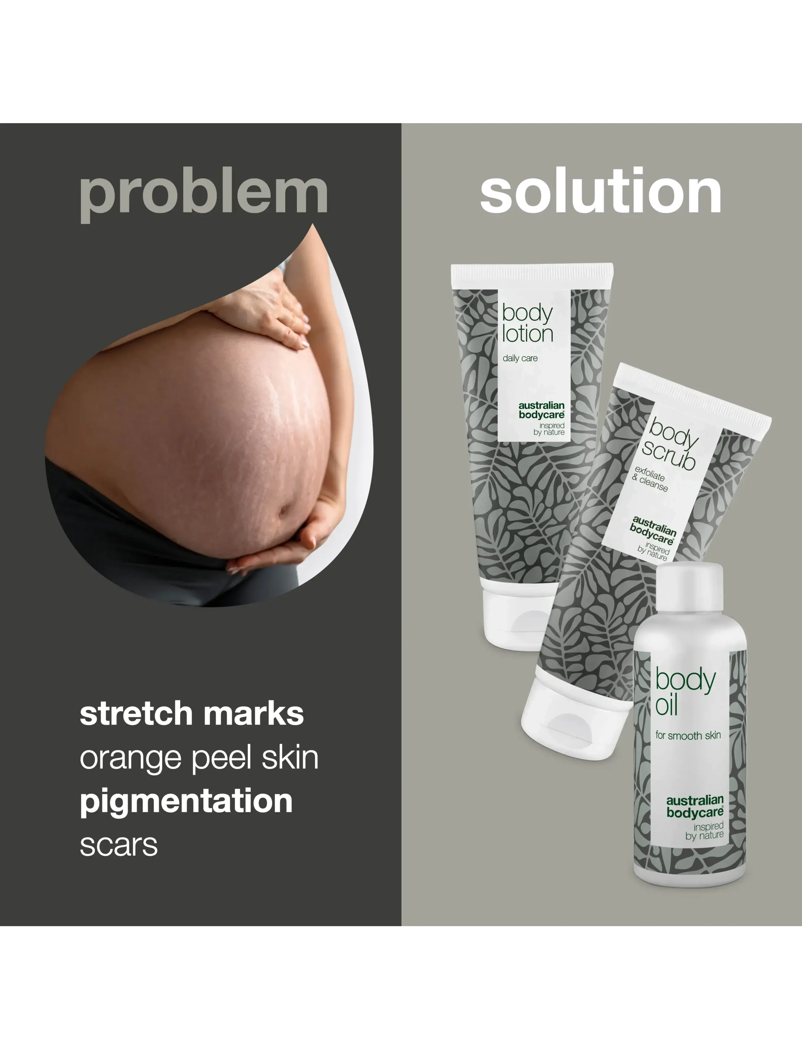 Australian Bodycare - Kit for daily care of stretch marks - til hende - tea tree oil - 1