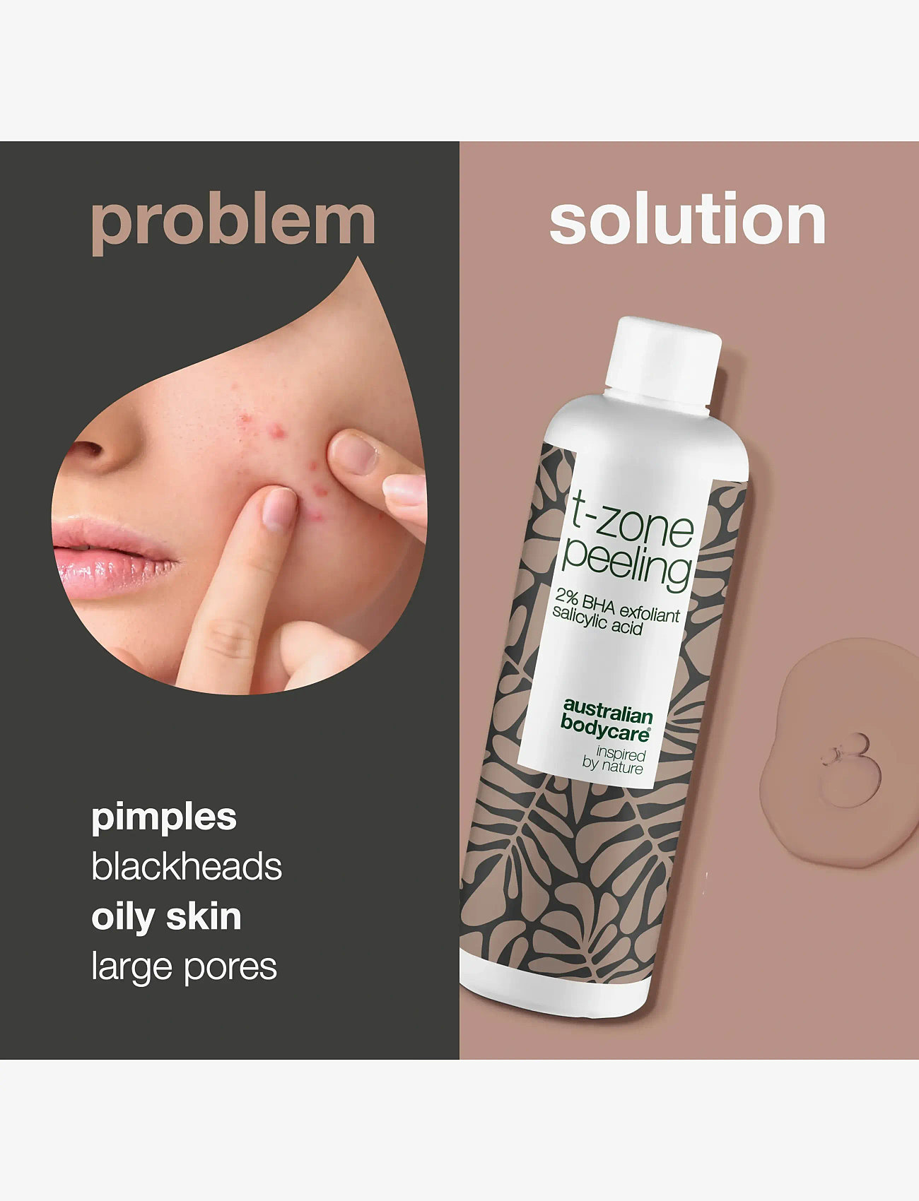 Australian Bodycare - T-zone peeling 150 ml - exfolierande ansiktsvatten - / - 1
