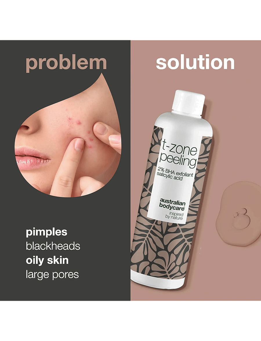 Australian Bodycare - T-zone peeling 150 ml - koorivad toonikud - / - 1