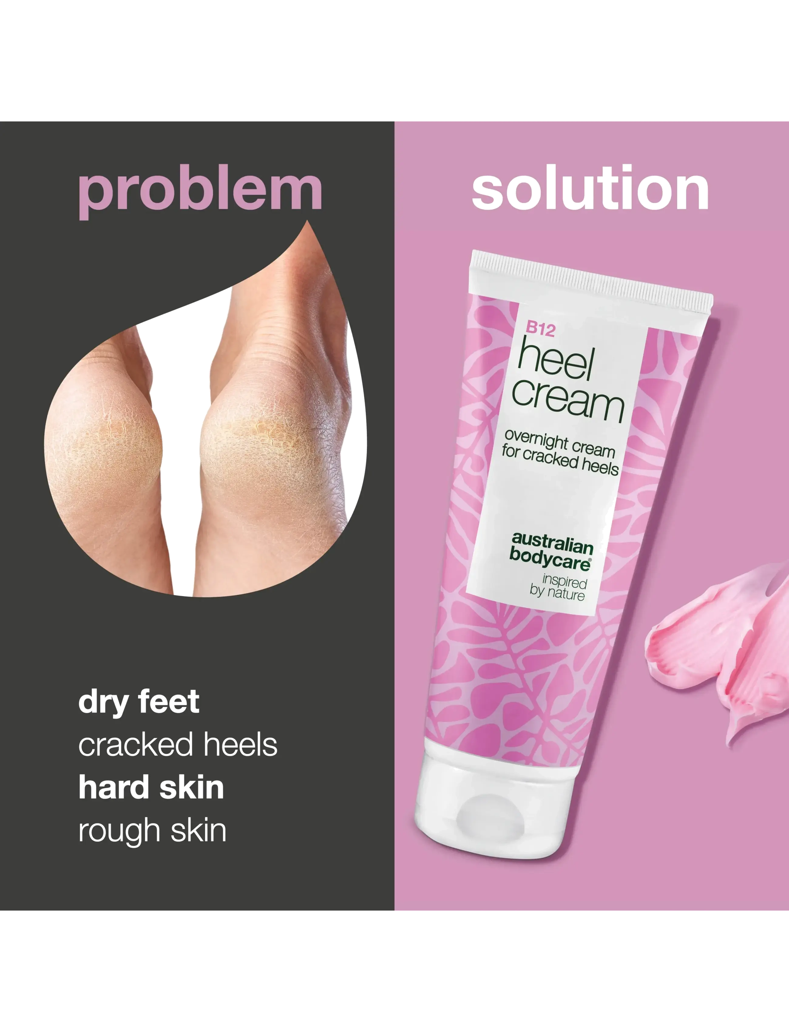 Australian Bodycare - B12 heel cream 100 ml - hendur og fætur - clear - 1