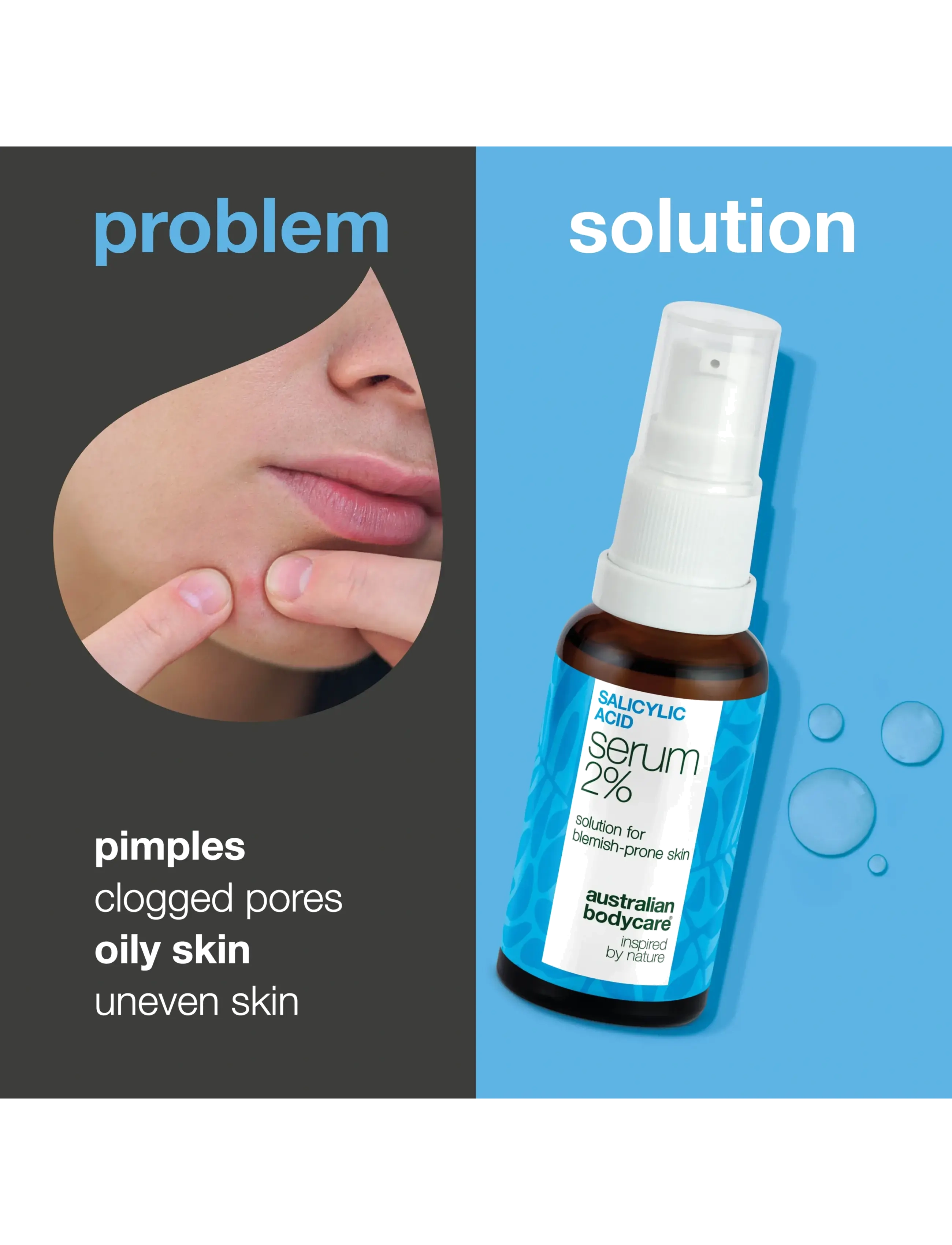 Australian Bodycare - Salicylic acid serum - 2% - 30 ml - ansigspleje - clear - 1