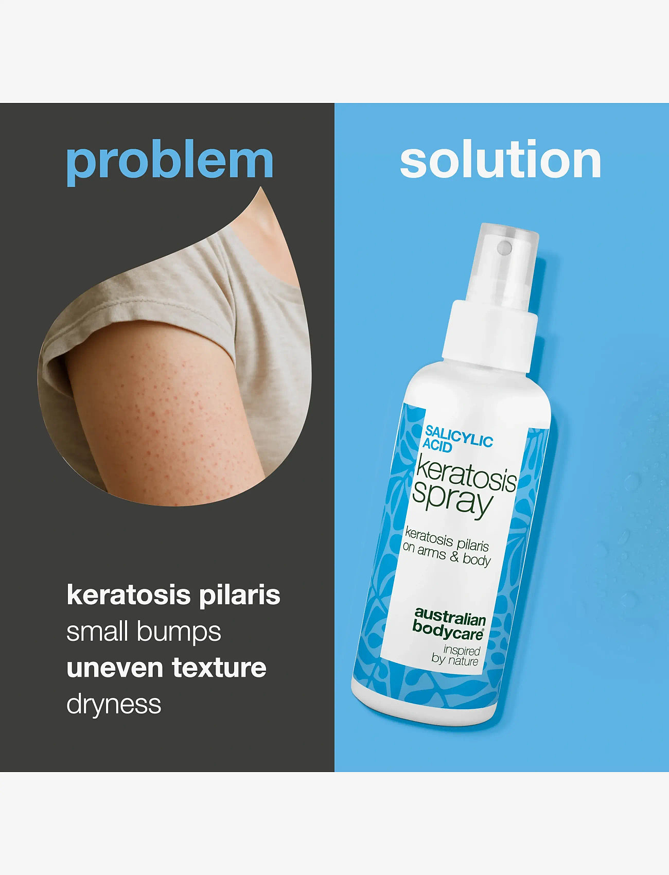Australian Bodycare - Salicylic Acid Keratosis spray 100 ml - skrub & exfoliering - krop - clear - 1