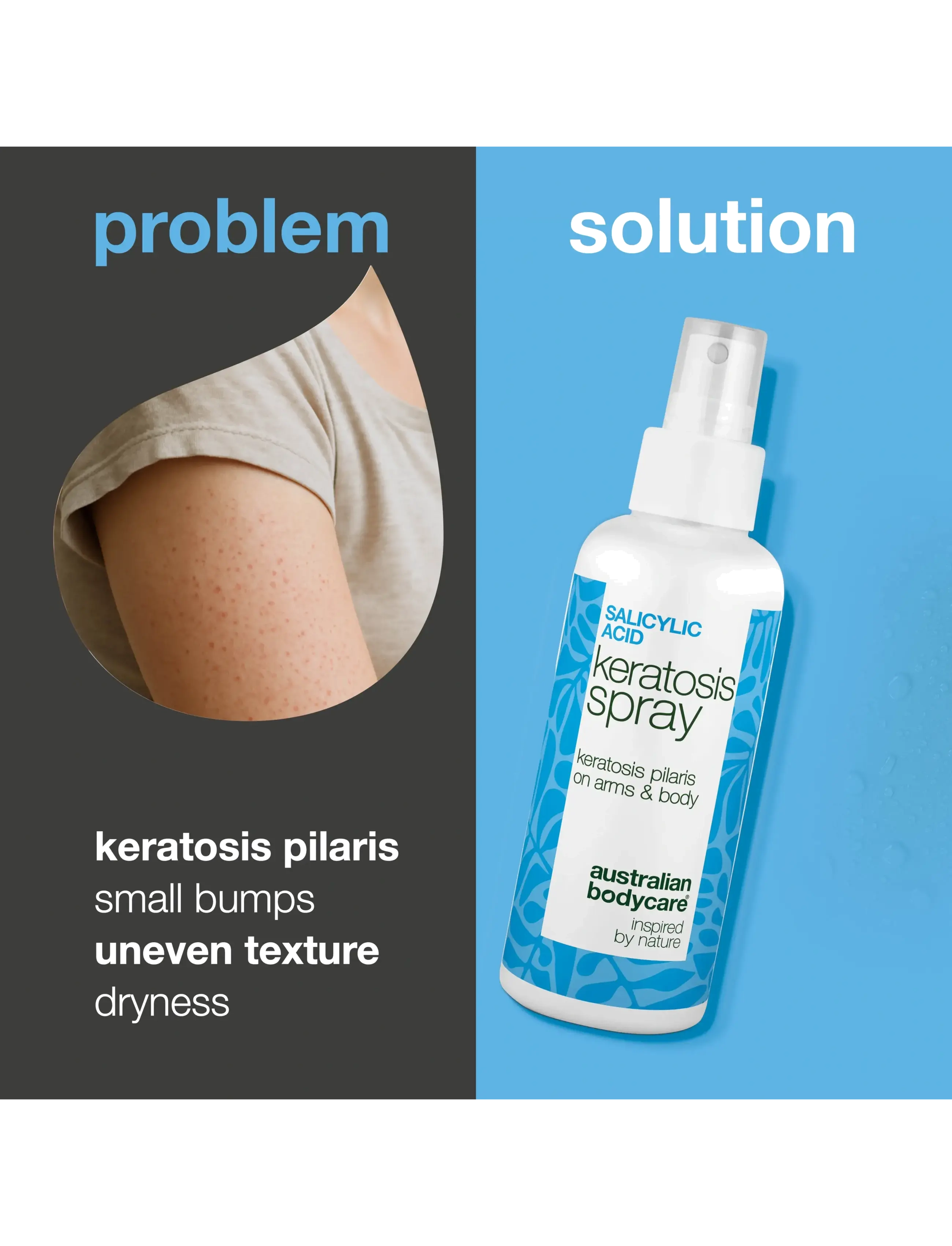 Australian Bodycare - Salicylic Acid Keratosis spray 100 ml - skrub & exfoliering - krop - clear - 1