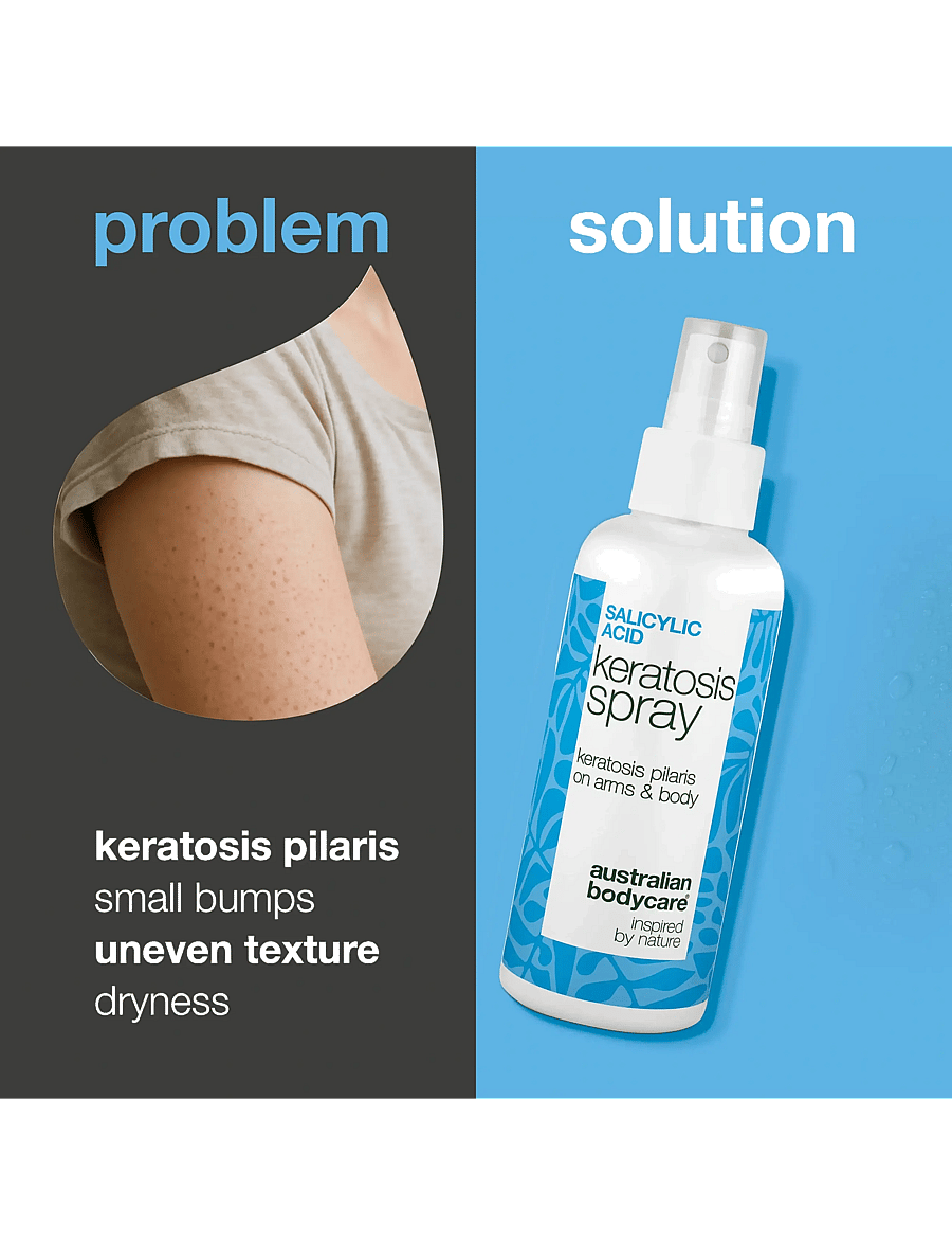 Australian Bodycare - Salicylic Acid Keratosis spray 100 ml - keha koorimine - clear - 1