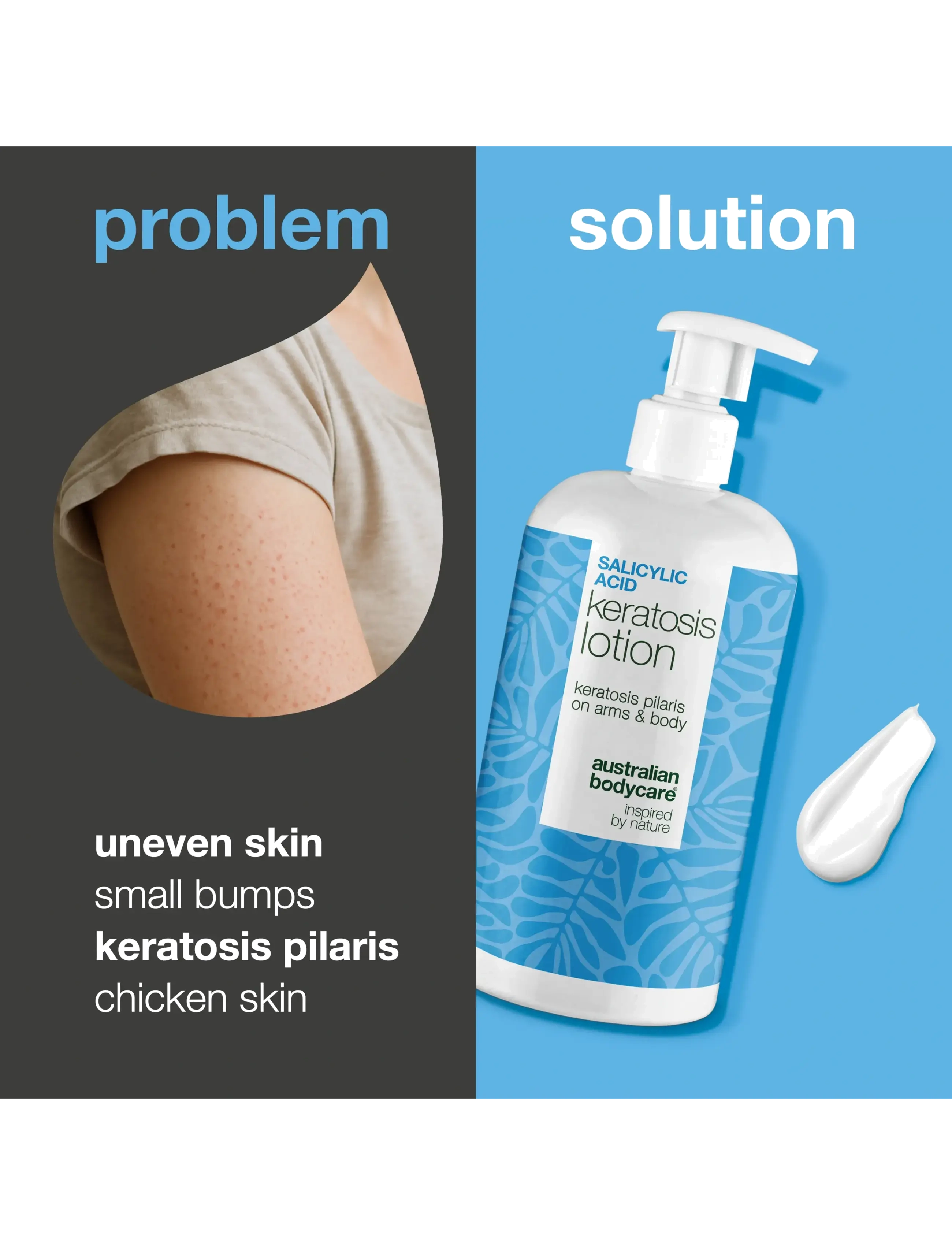 Australian Bodycare - Salicylic Acid Keratosis Lotion - 500 ml - lotion & creme - clear - 2