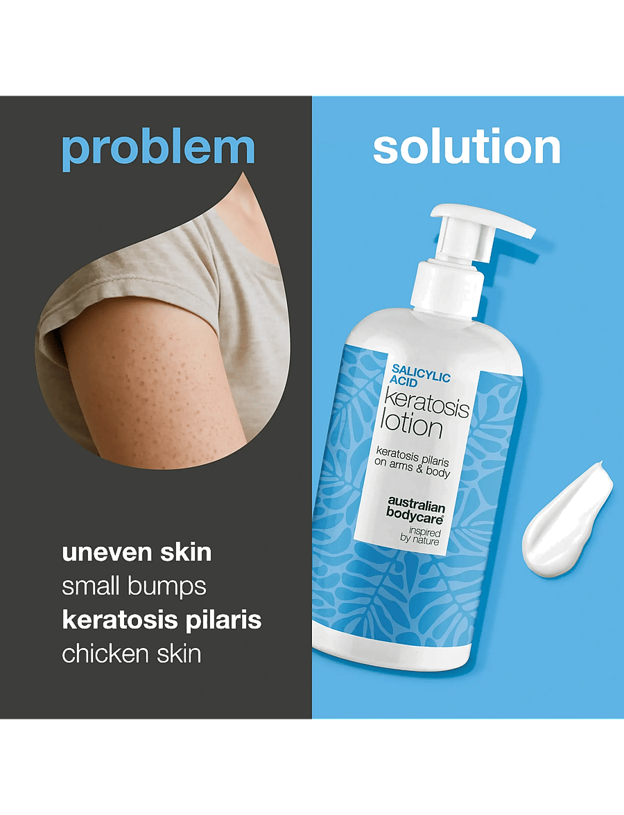 Australian Bodycare - Salicylic Acid Keratosis Lotion - 500 ml - lotion & creme - clear - 2