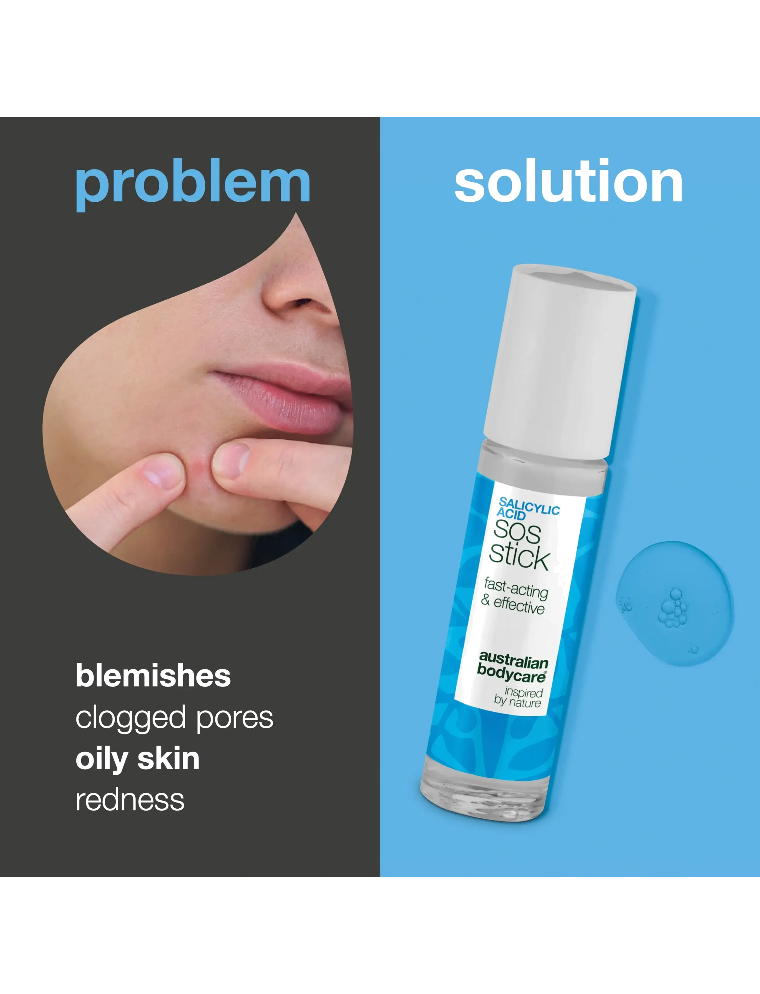 Australian Bodycare - Salicylic acid sos stick 9 ml - ansigspleje - clear - 1