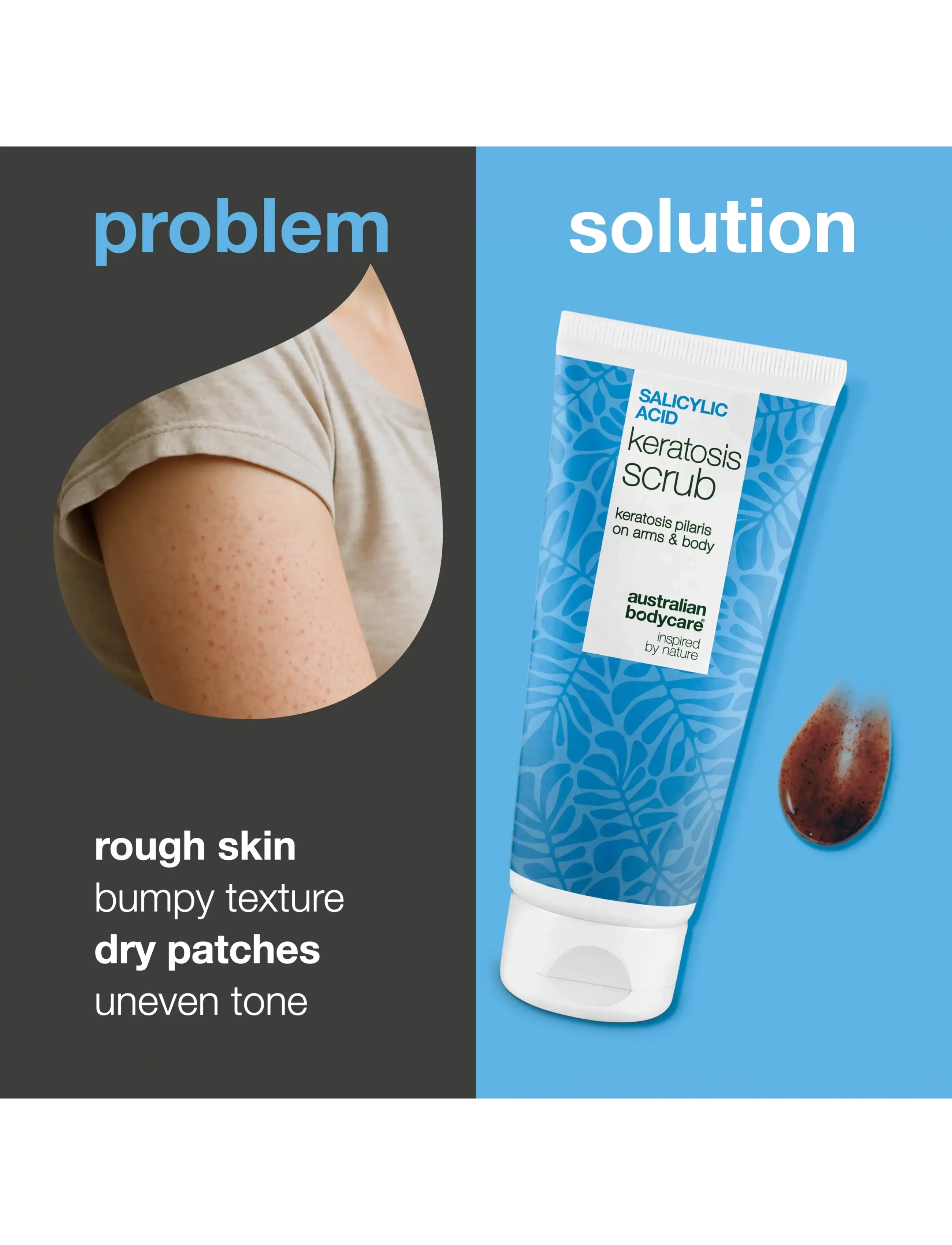 Australian Bodycare - Salicylic Acid Keratosis Scrub - 200 ml - skrub & exfoliering - krop - clear - 1
