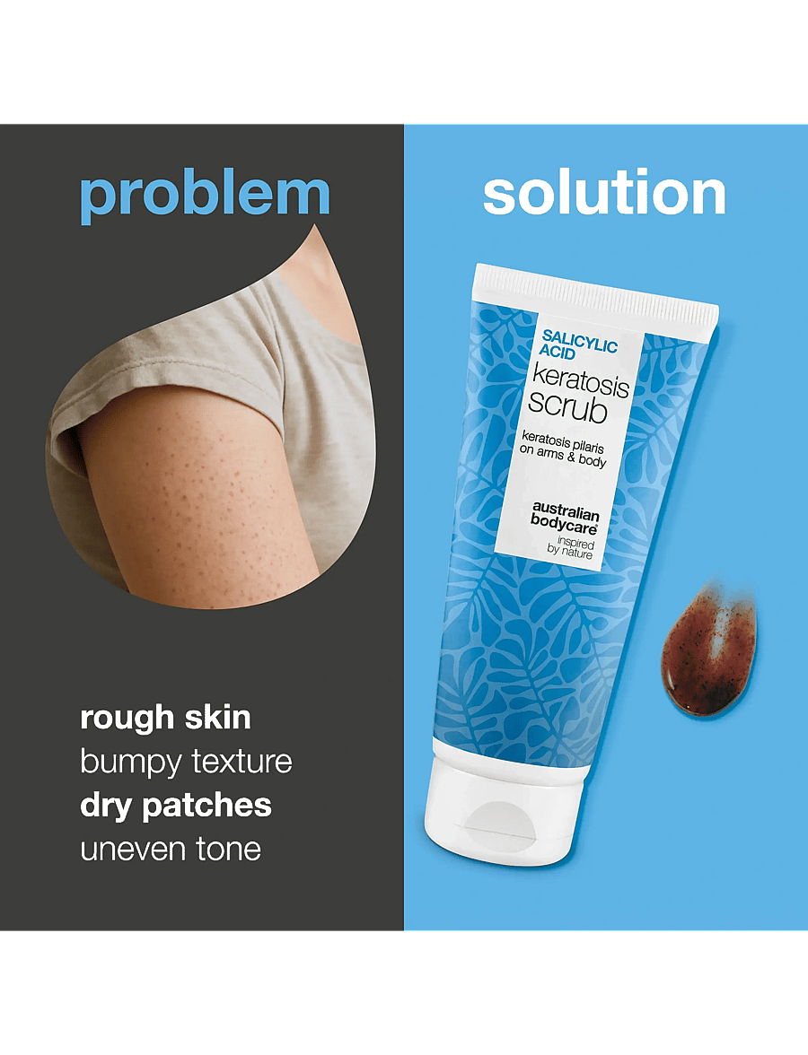 Australian Bodycare - Salicylic Acid Keratosis Scrub - 200 ml - keha koorimine - clear - 1