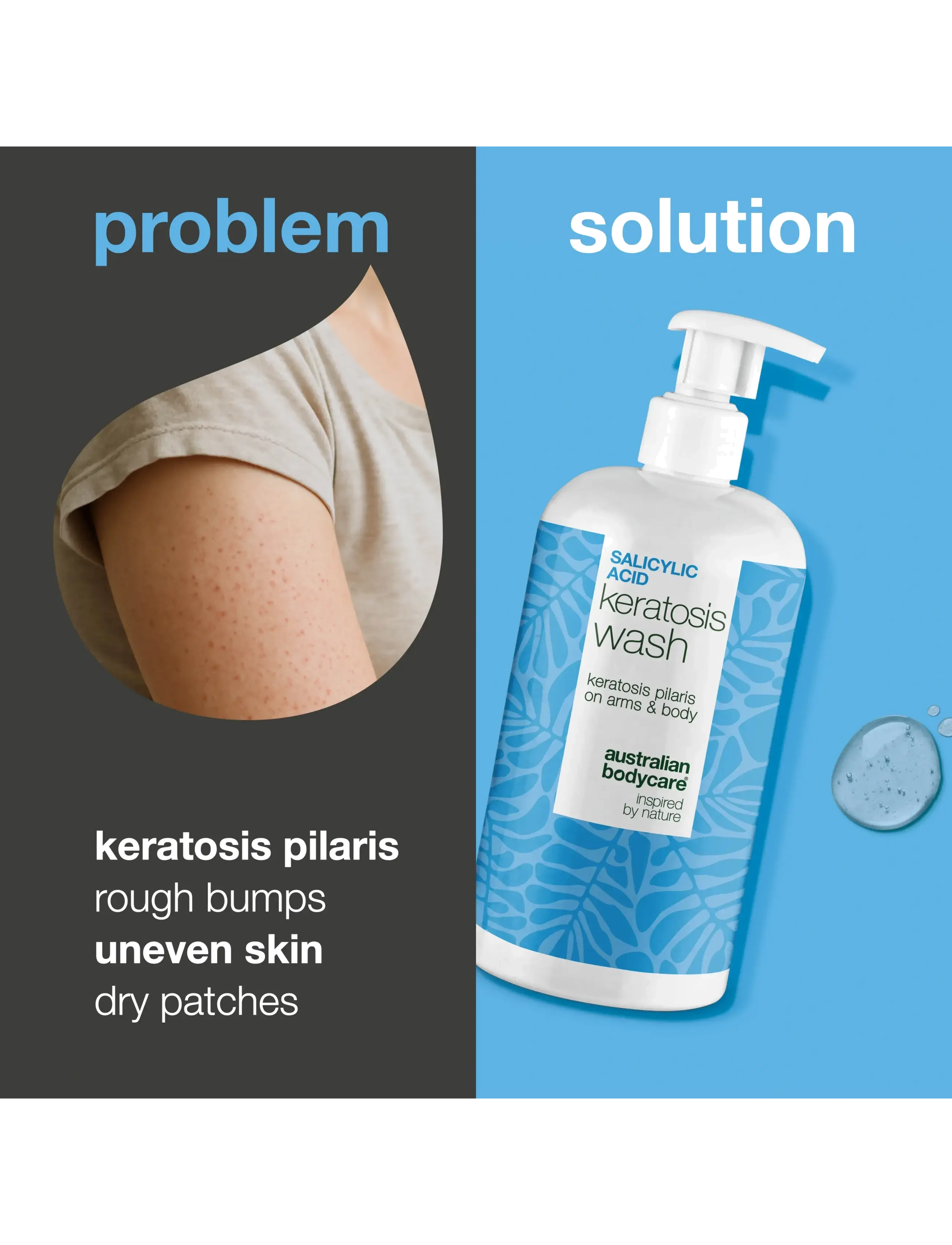 Australian Bodycare - Salicylic Acid Keratosis Wash 500 ml - shower gel & bruseolier - clear - 1