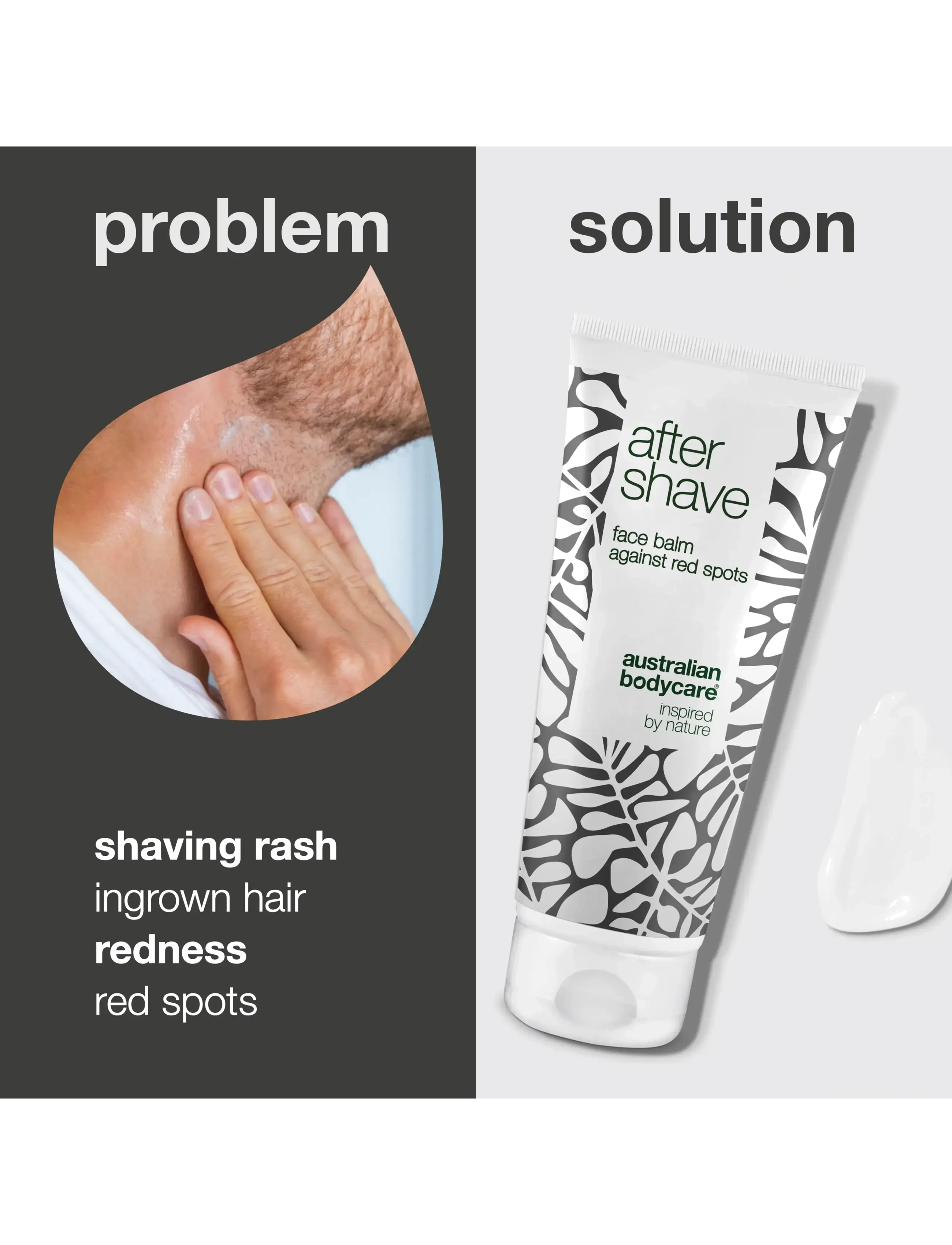 Australian Bodycare - After Shave - aftershave balm against shaving rash and ingrown hair - 100 ml - aftershave - no color - 2