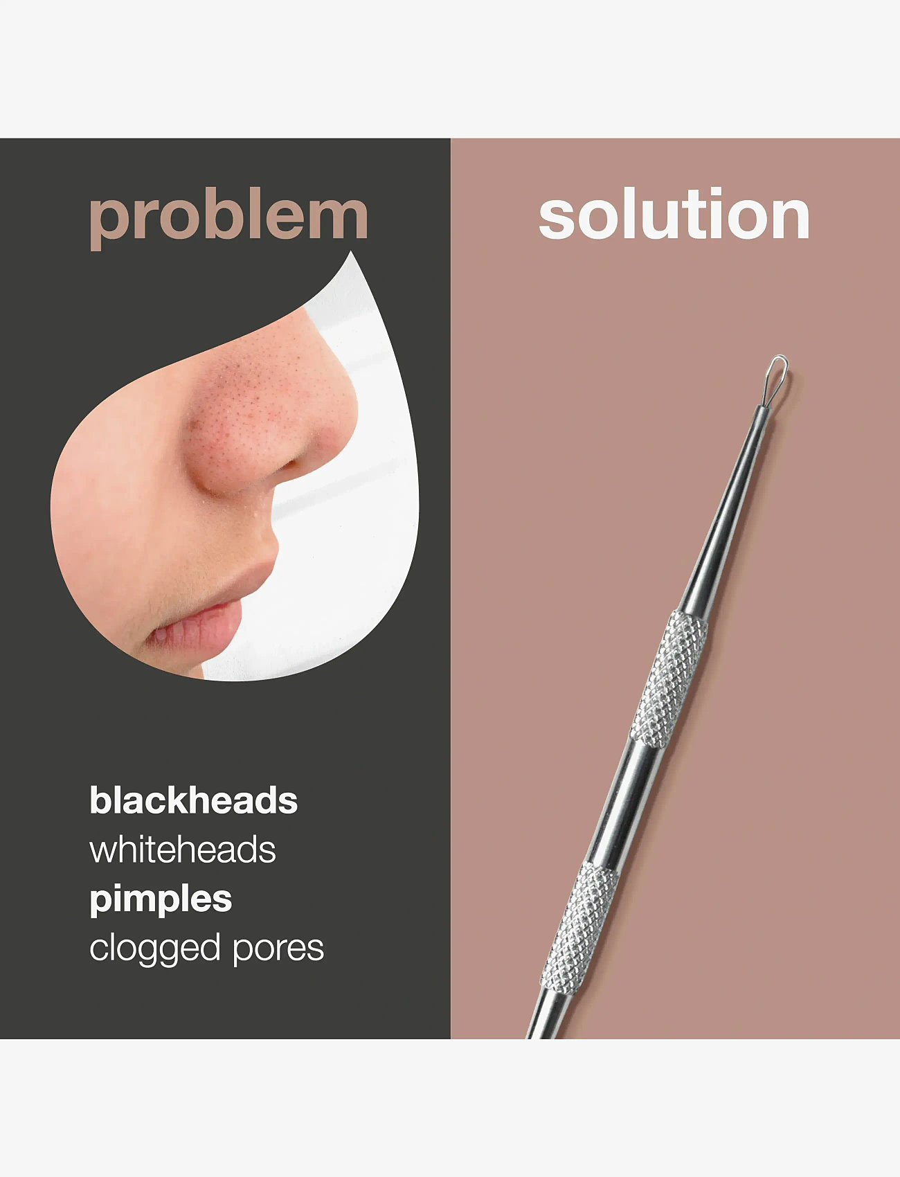Australian Bodycare - Blackhead Remover for pimples & blackheads - gydomosios priemonės nuo spuogų - no color - 2
