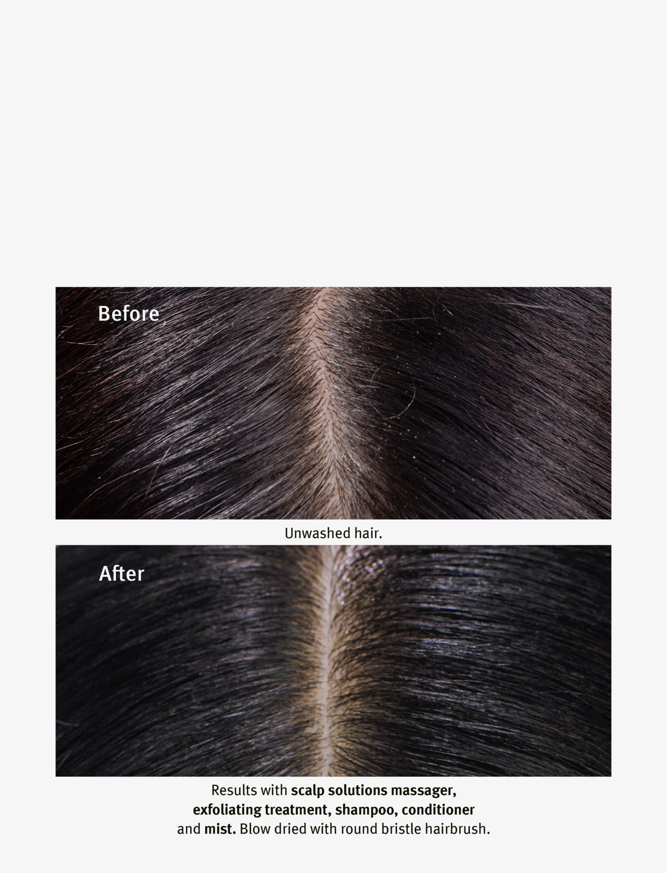 Aveda - Scalp Solutions Stimulating Scalp Massager - scalp treatment - no color - 4