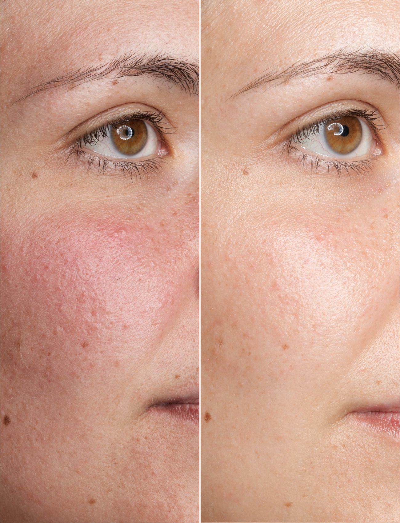 Babor - Doctor Babor Ampoule Beta Glucane - serums & oils - no colour - 4