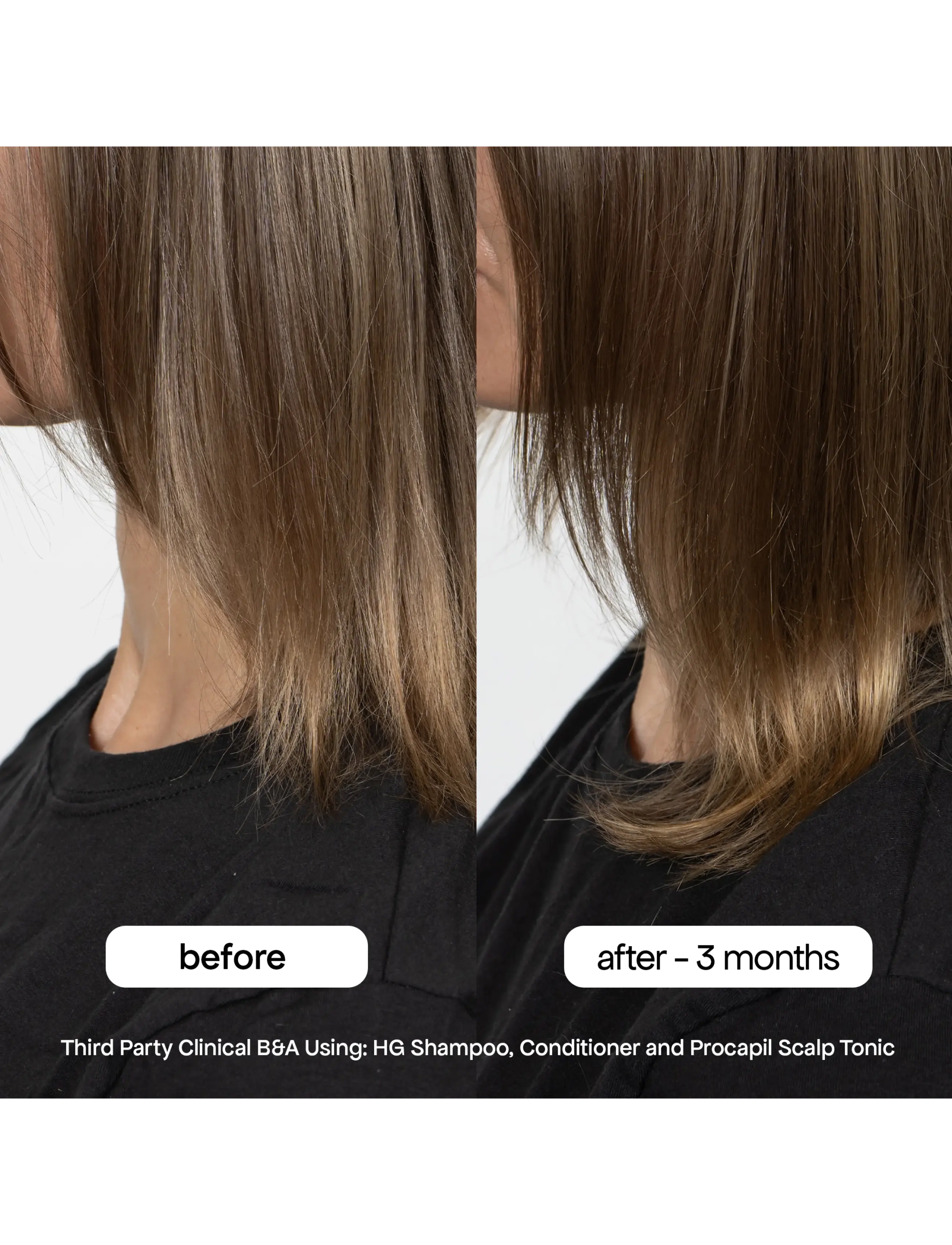 Bondi Boost - HG Anti-Thinning Conditioner - clear - 2
