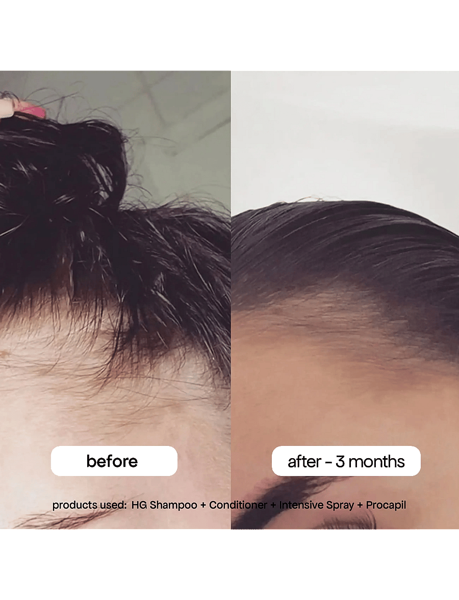 Bondi Boost - HG Anti-Thinning Intensive Scalp Spray - hoidot hiuspohjalle - clear - 3