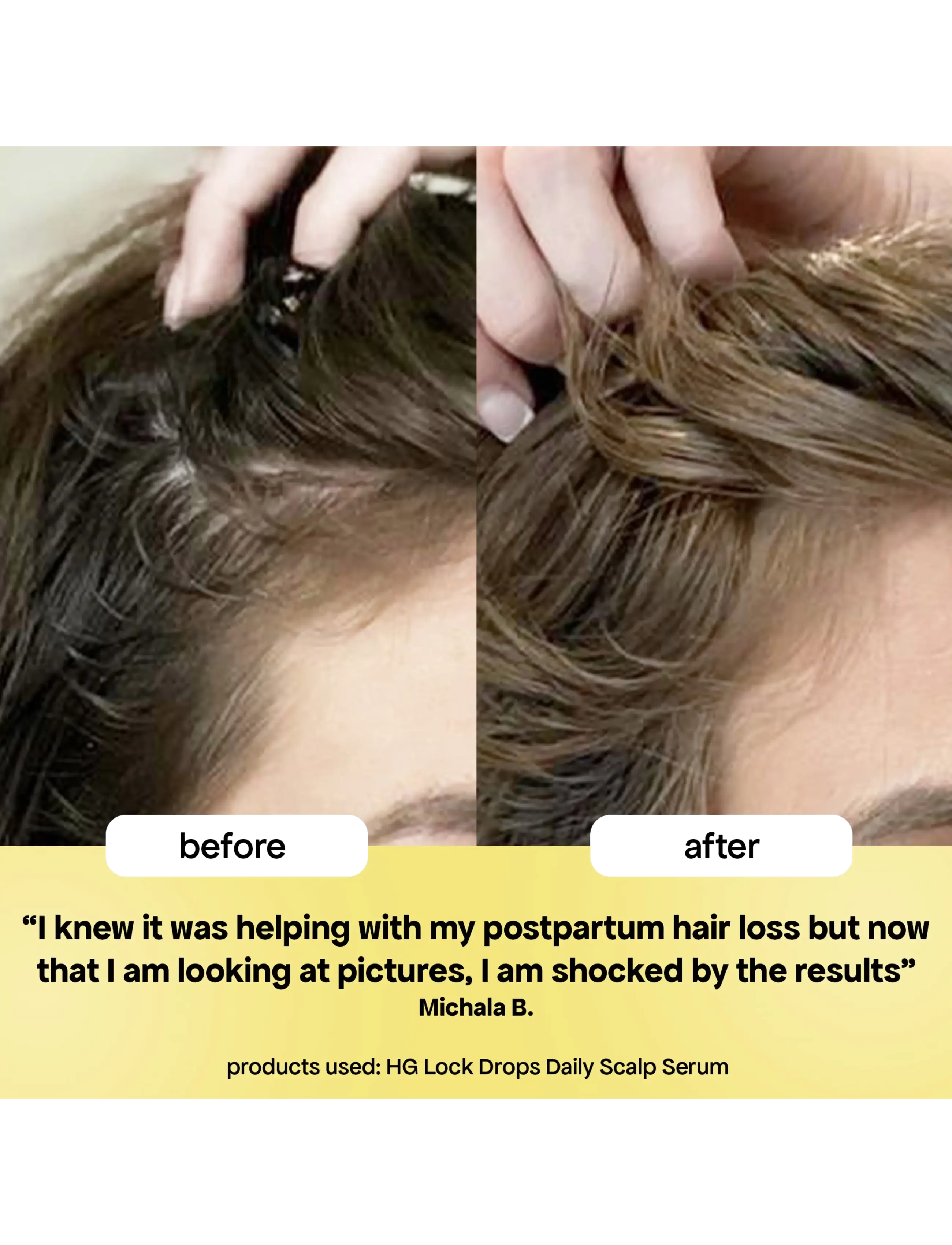 Bondi Boost - HG Lock Drops For Thinning Hair - hår - clear - 4