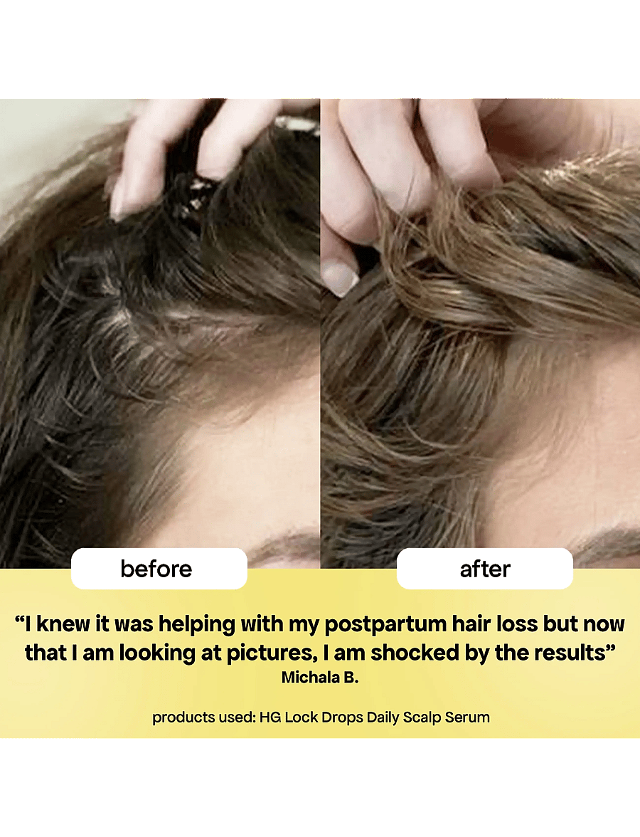 Bondi Boost - HG Lock Drops For Thinning Hair - hår - clear - 4
