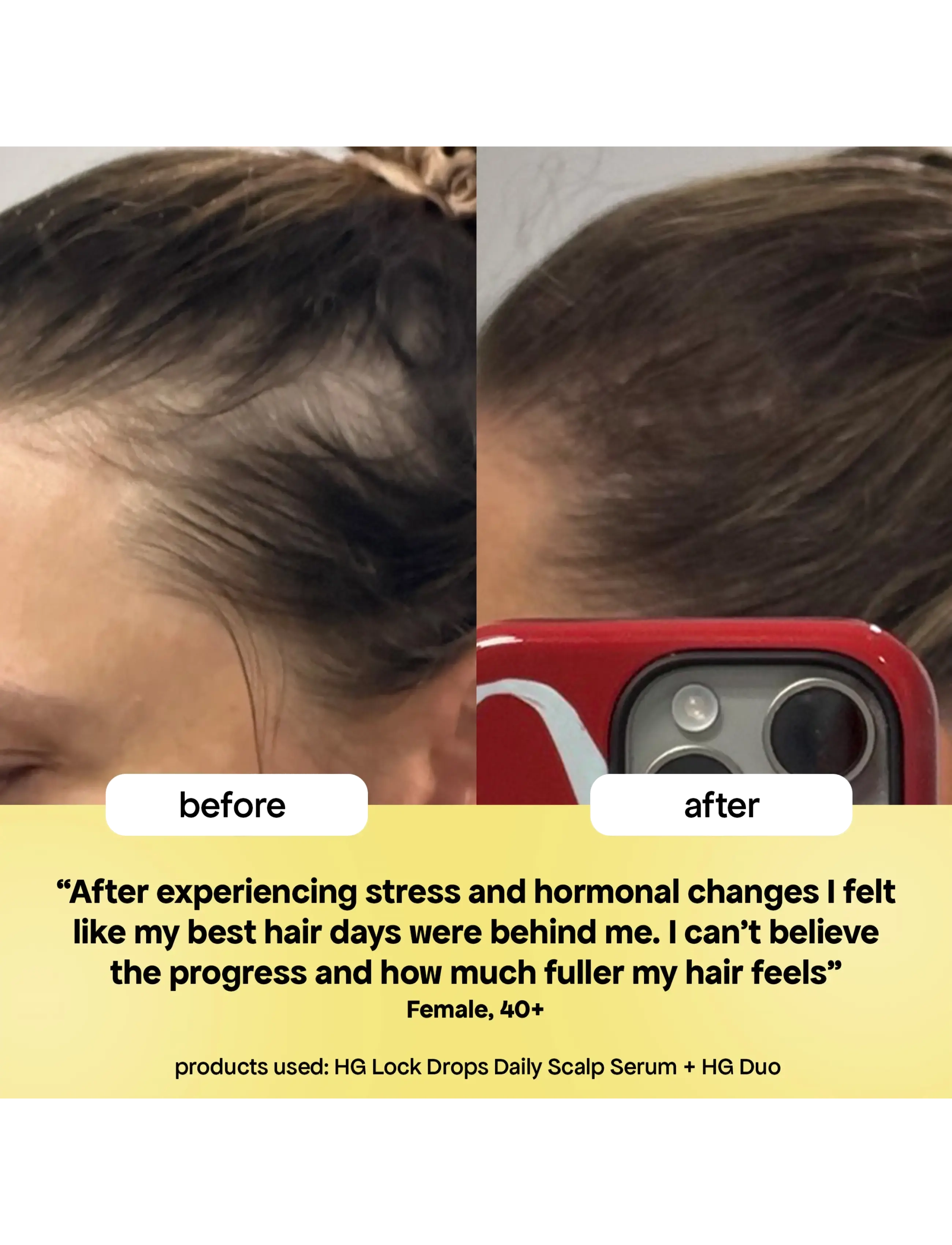 Bondi Boost - HG Lock Drops For Thinning Hair - hår - clear - 5