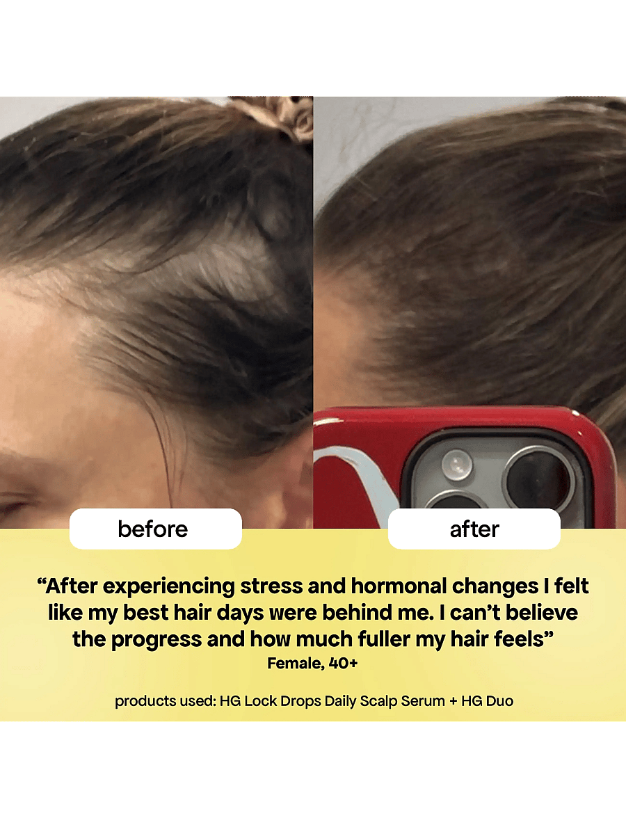 Bondi Boost - HG Lock Drops For Thinning Hair - hår - clear - 5
