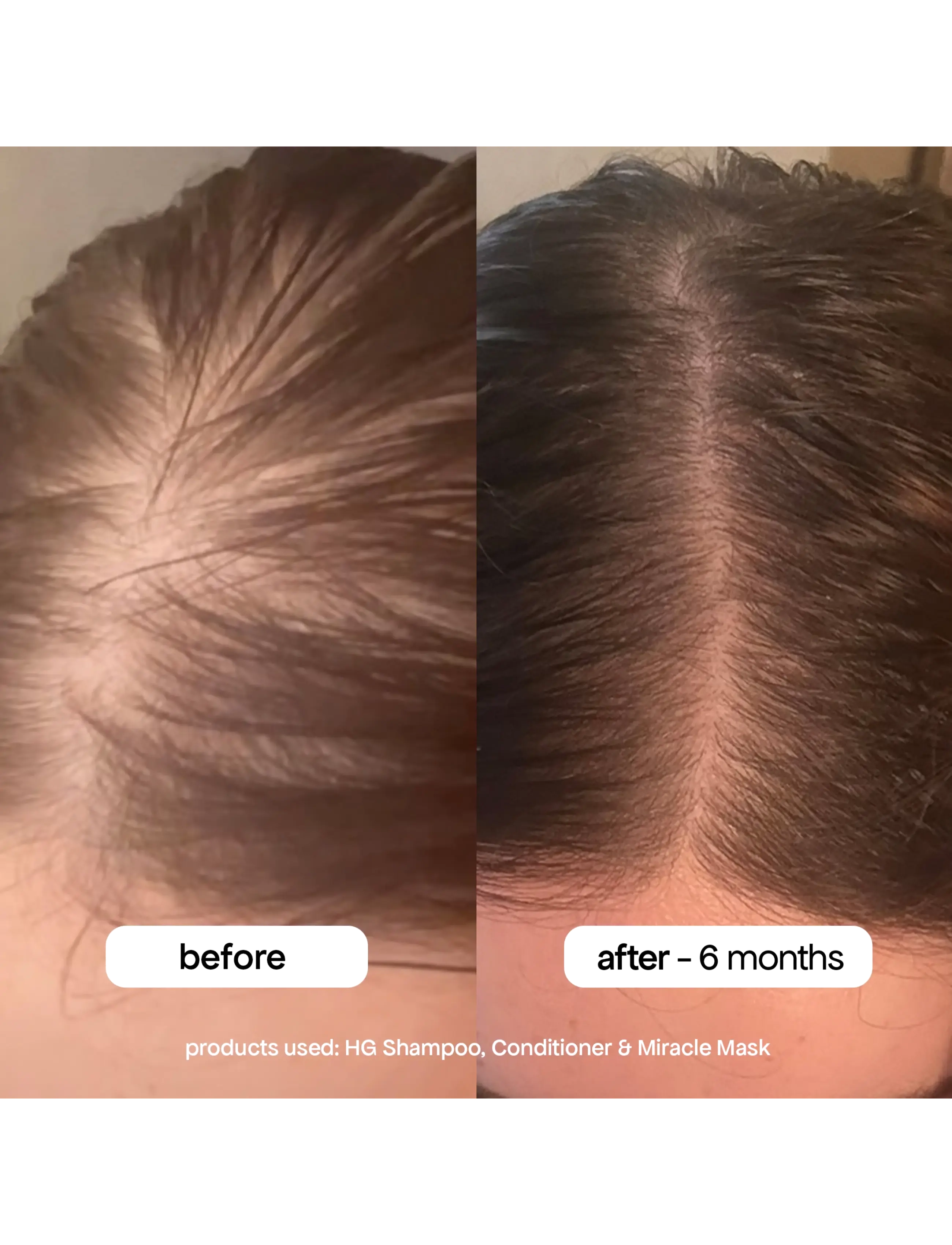 Bondi Boost - HG Miracle Hair Mask - hårinpackning - clear - 5