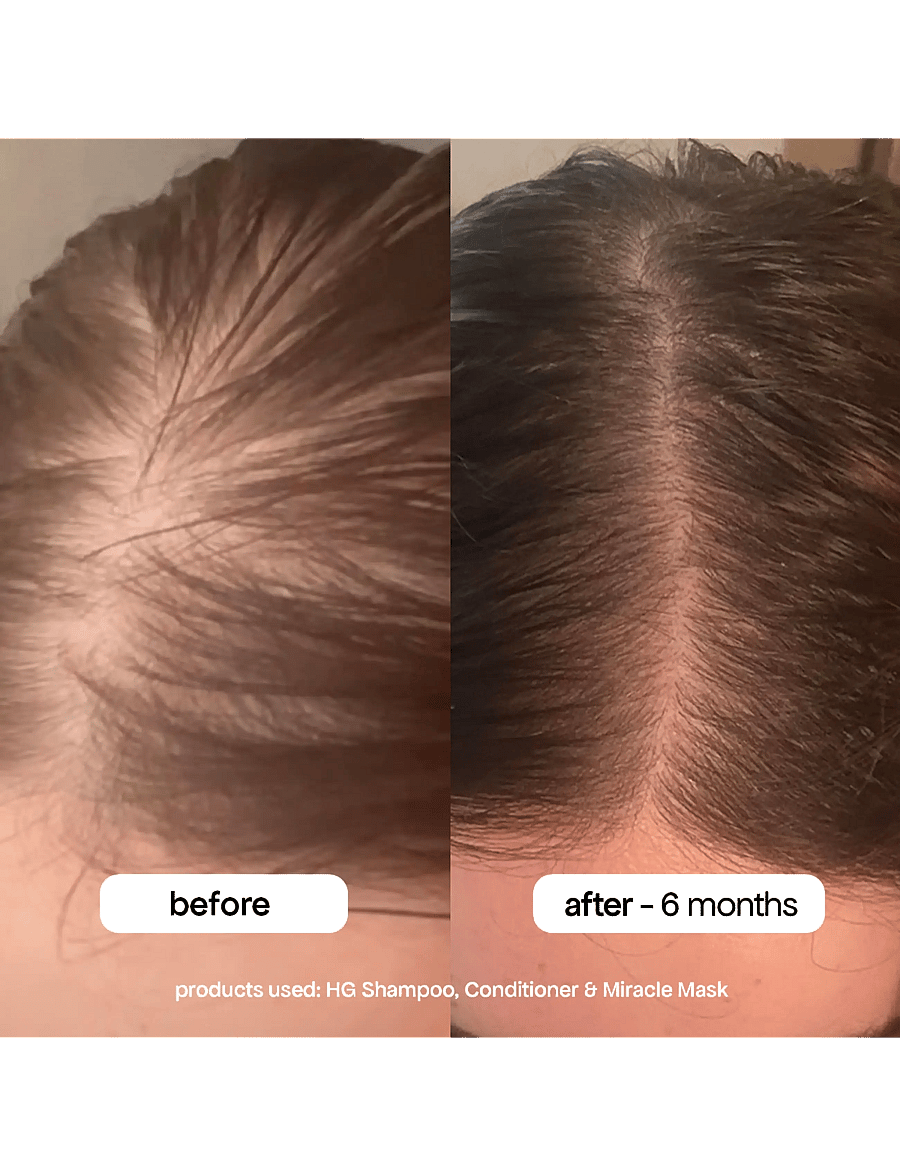 Bondi Boost - HG Miracle Hair Mask - hårinpackning - clear - 5
