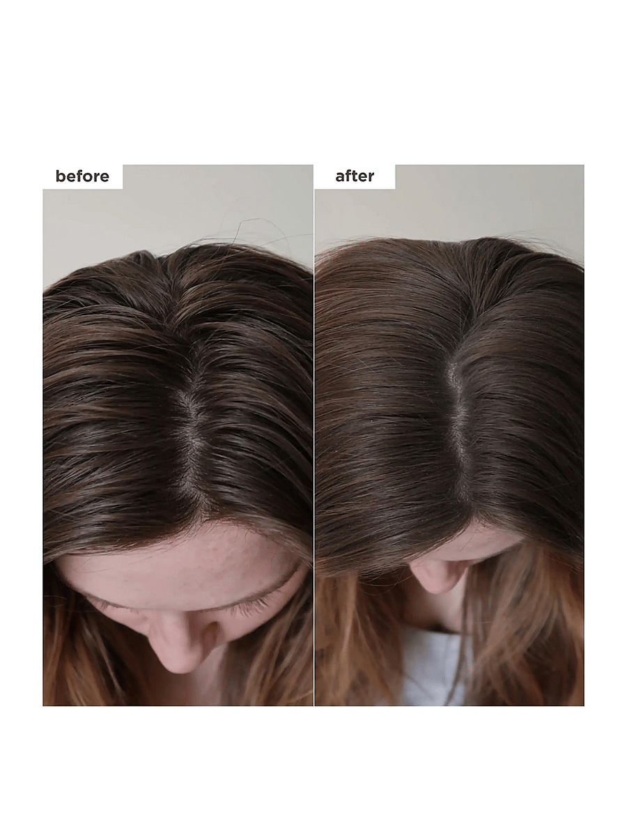 Briogeo - Briogeo Scalp Revival™ Charcoal + Biotin Dry Shampoo 50ml - sommarens hårprodukter - no colour - 1