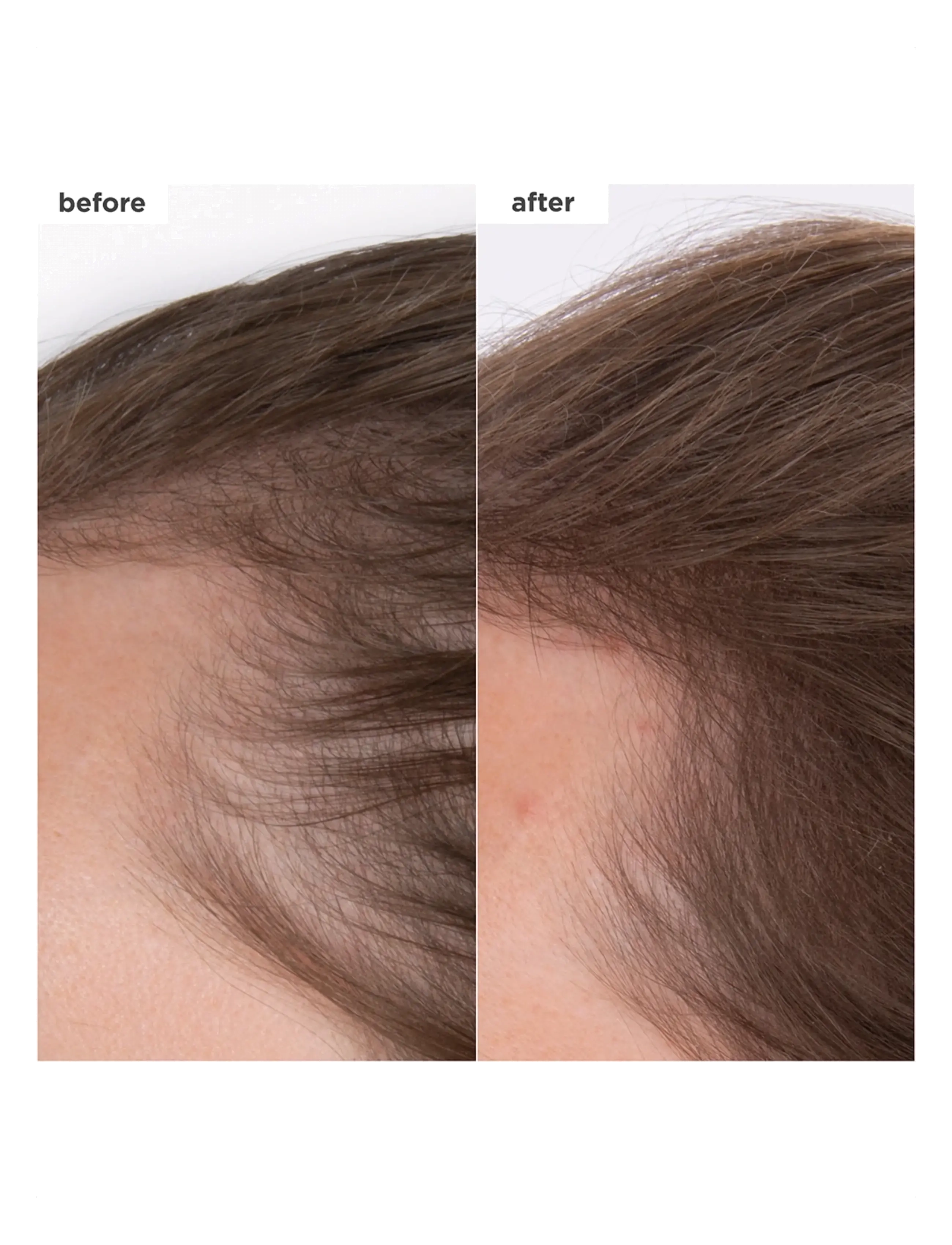 Briogeo - Briogeo Destined For Density™ MegaStrength + Caffeine + Biotin Peptide Density Serum 45ml - hår - clear - 1