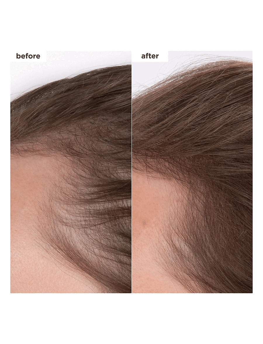 Briogeo - Briogeo Destined For Density™ MegaStrength + Caffeine + Biotin Peptide Density Serum 45ml - hår - clear - 1