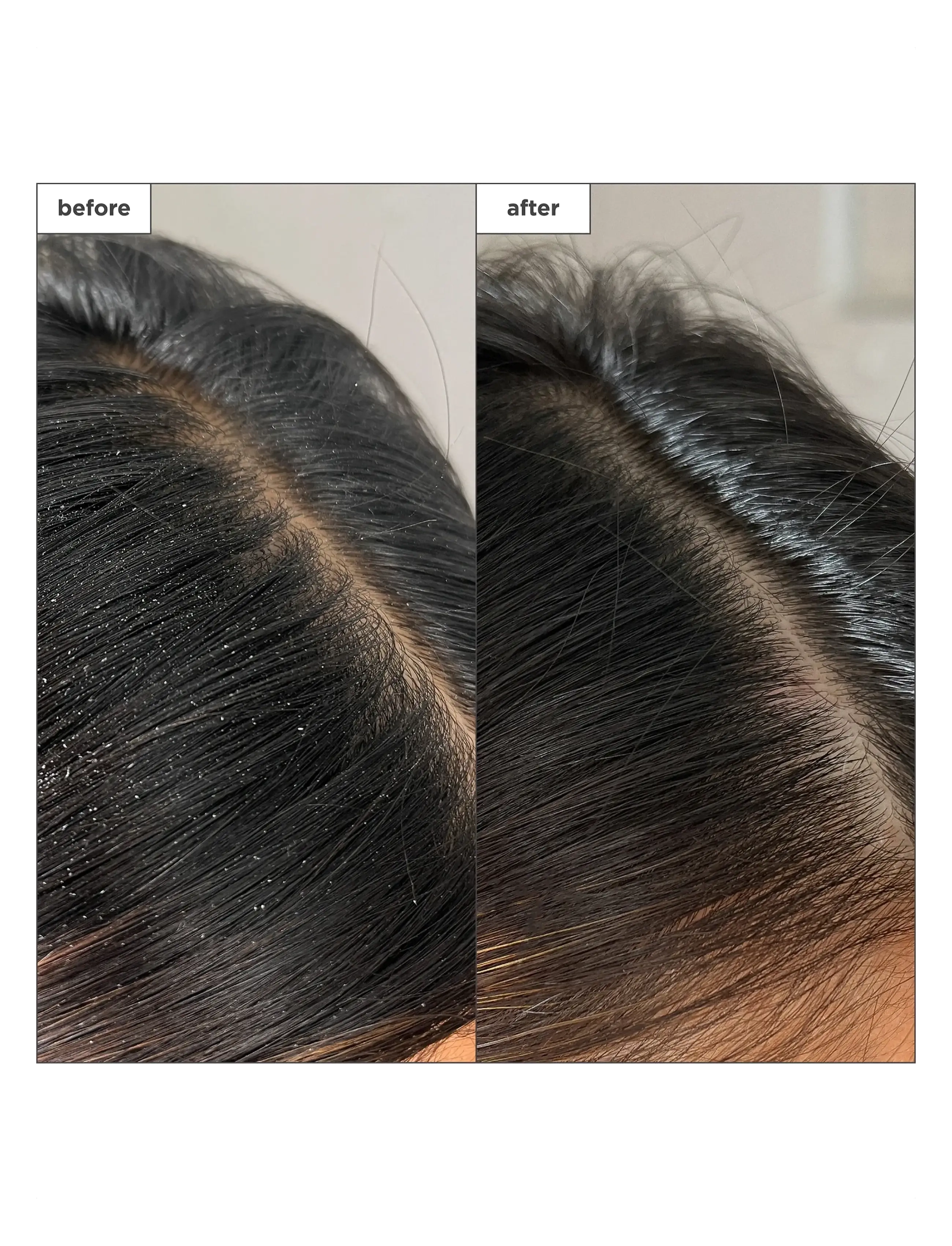 Briogeo - Briogeo Scalp Revival™ Charcoal + Tea Tree Buildup Detox Spray 120ml - hårkur - clear - 1