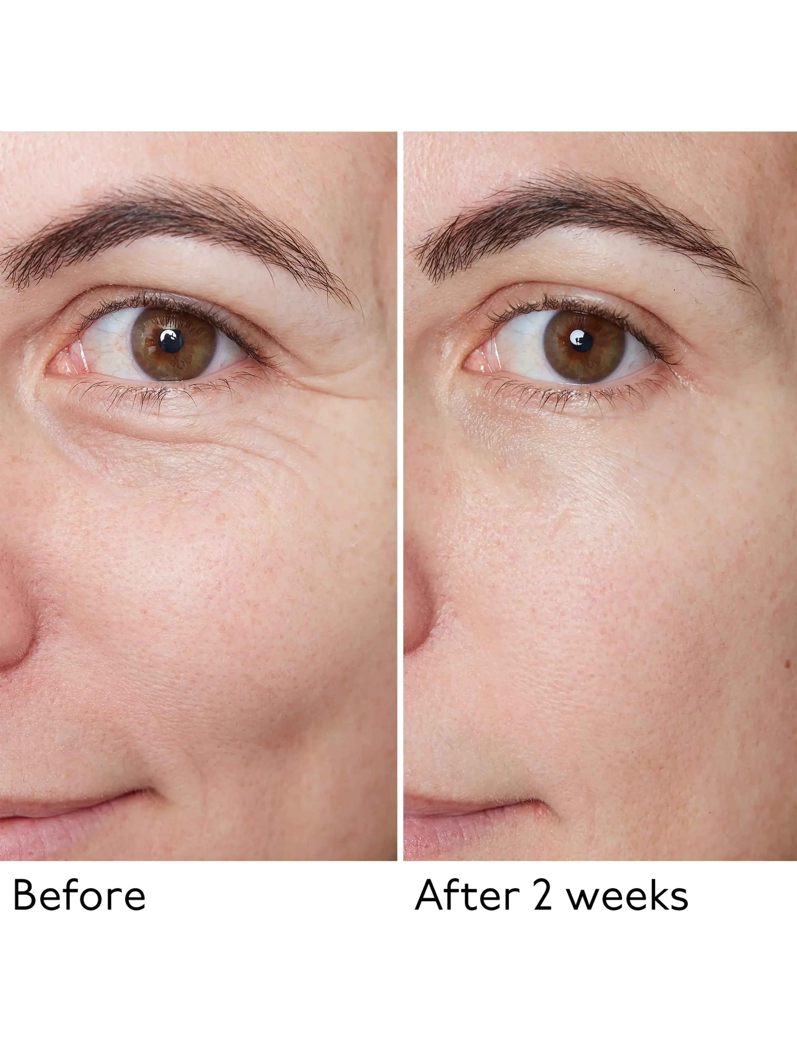 By Terry - Hyaluronic Global Serum - serum - no color - 2