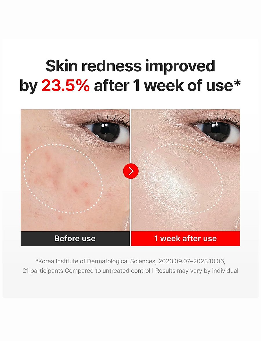 Centellian24 - Madeca Cream Time Reverse - niisutajad - clear - 2