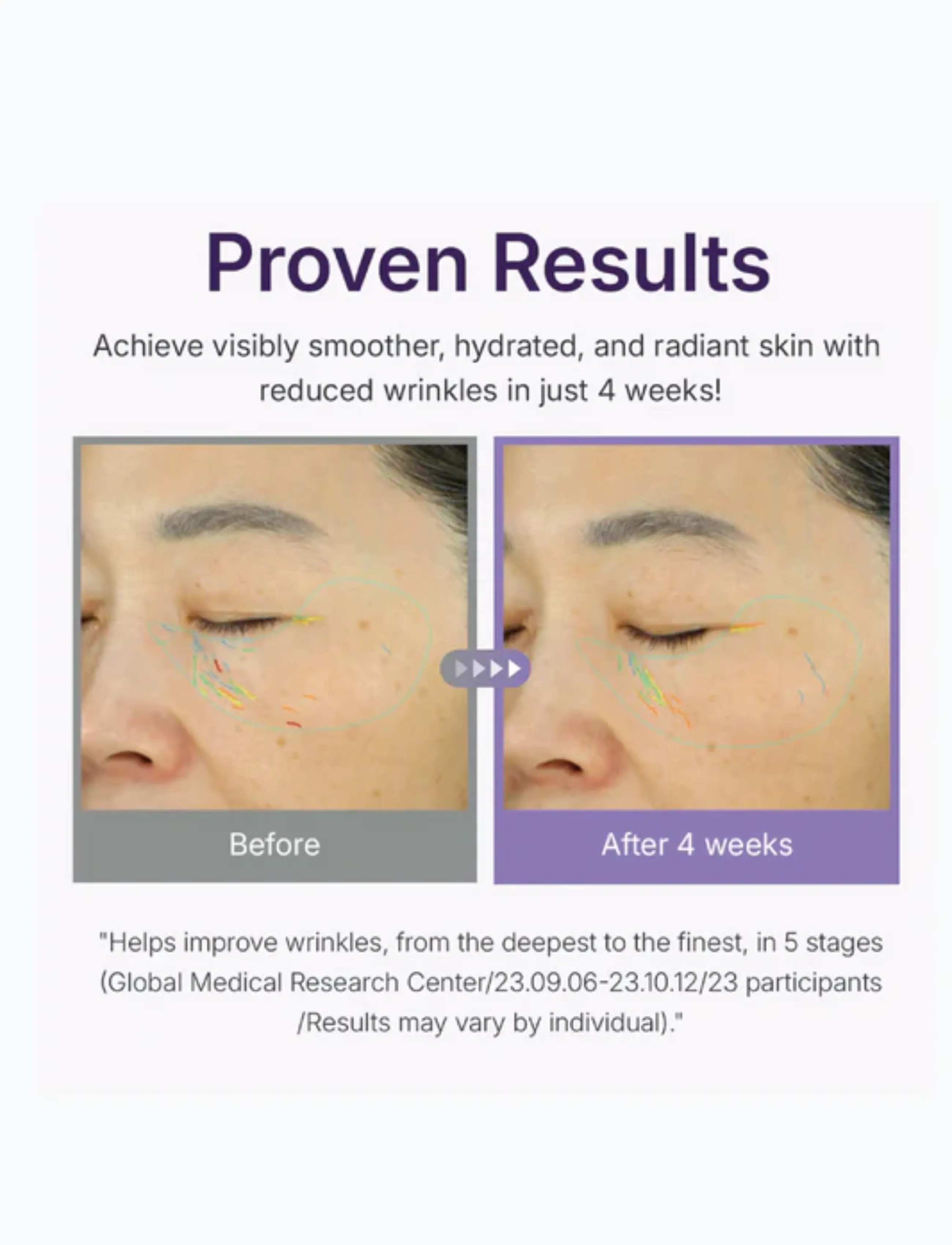 Centellian24 - 360º Shot PDRN Lifting Eye Cream - Øjencremer - clear - 3