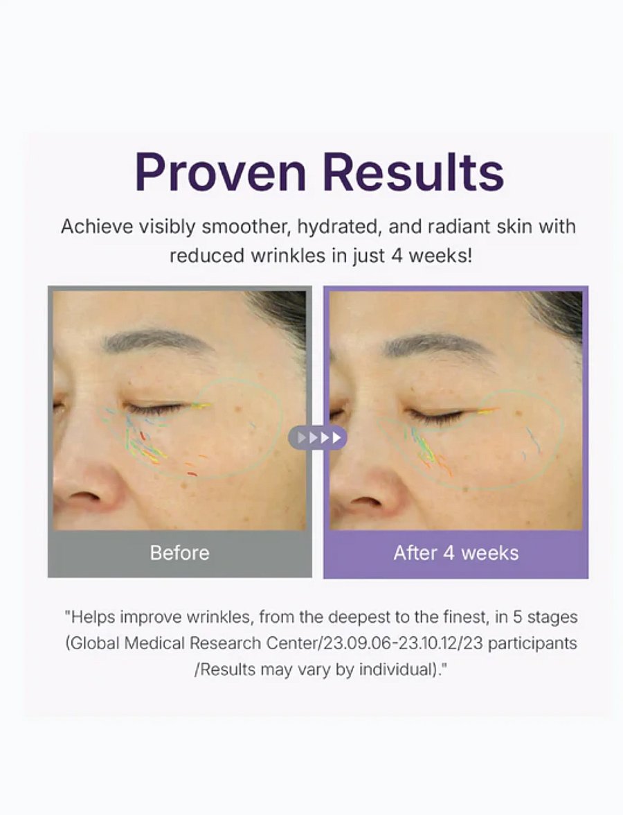Centellian24 - 360º Shot PDRN Lifting Eye Cream - silmakreem - clear - 3