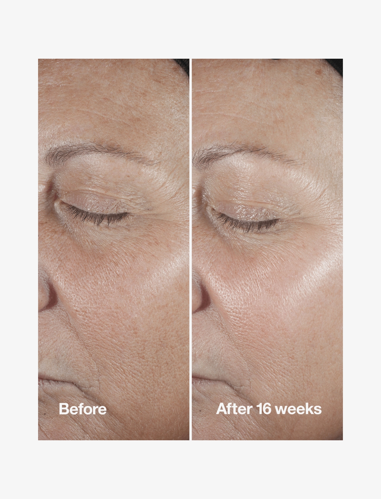 Clinique - Smart Clinical Repair Wrinkle Correcting Serum - serum og oljer - clear - 3