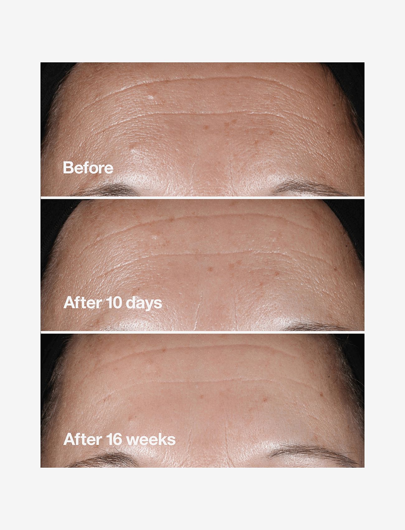 Clinique - Smart Clinical Repair Wrinkle Correcting Serum - serum & oljor  - clear - 4