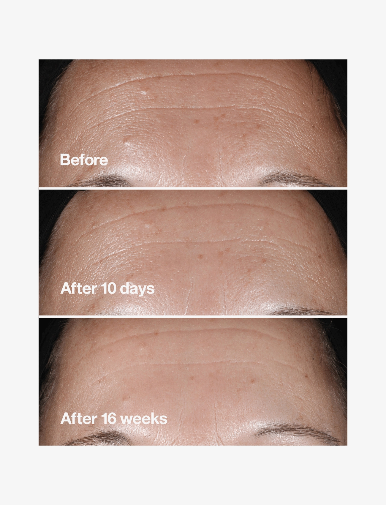 Clinique - Smart Clinical Repair Wrinkle Correcting Serum - serum og oljer - clear - 4