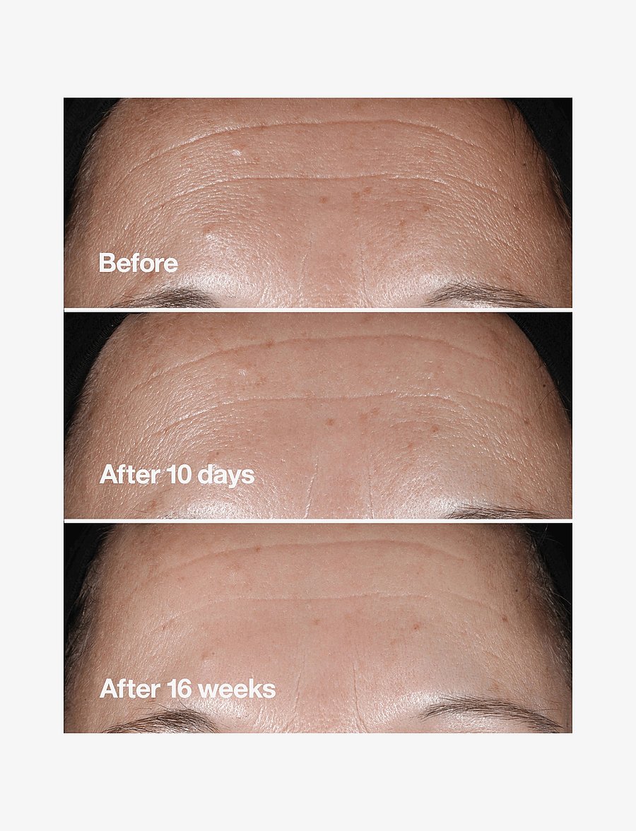 Clinique - Smart Clinical Repair Wrinkle Correcting Serum - serum og olíur - clear - 4
