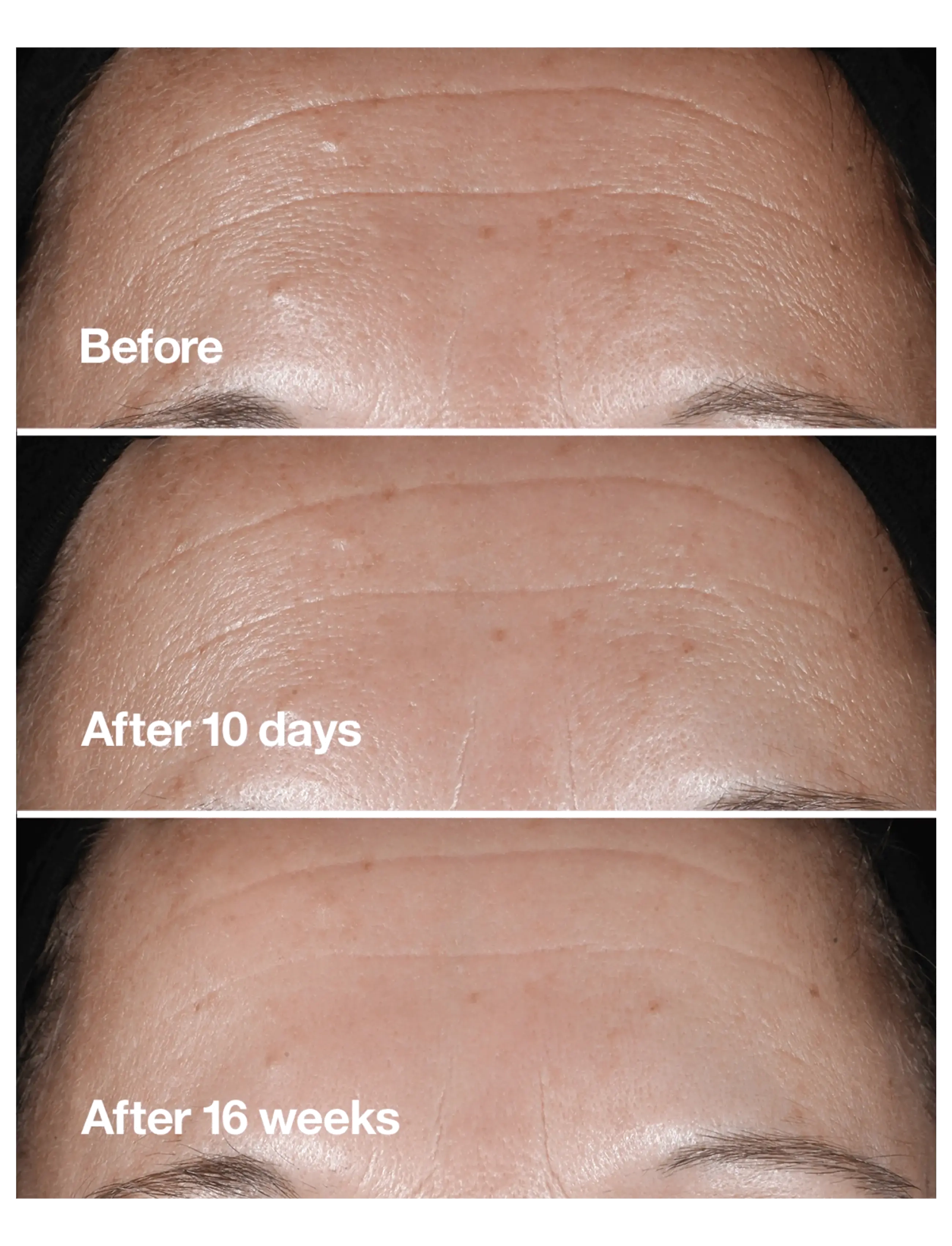 Clinique - Smart Clinical Repair Wrinkle Correcting Serum - serum & olier - clear - 2