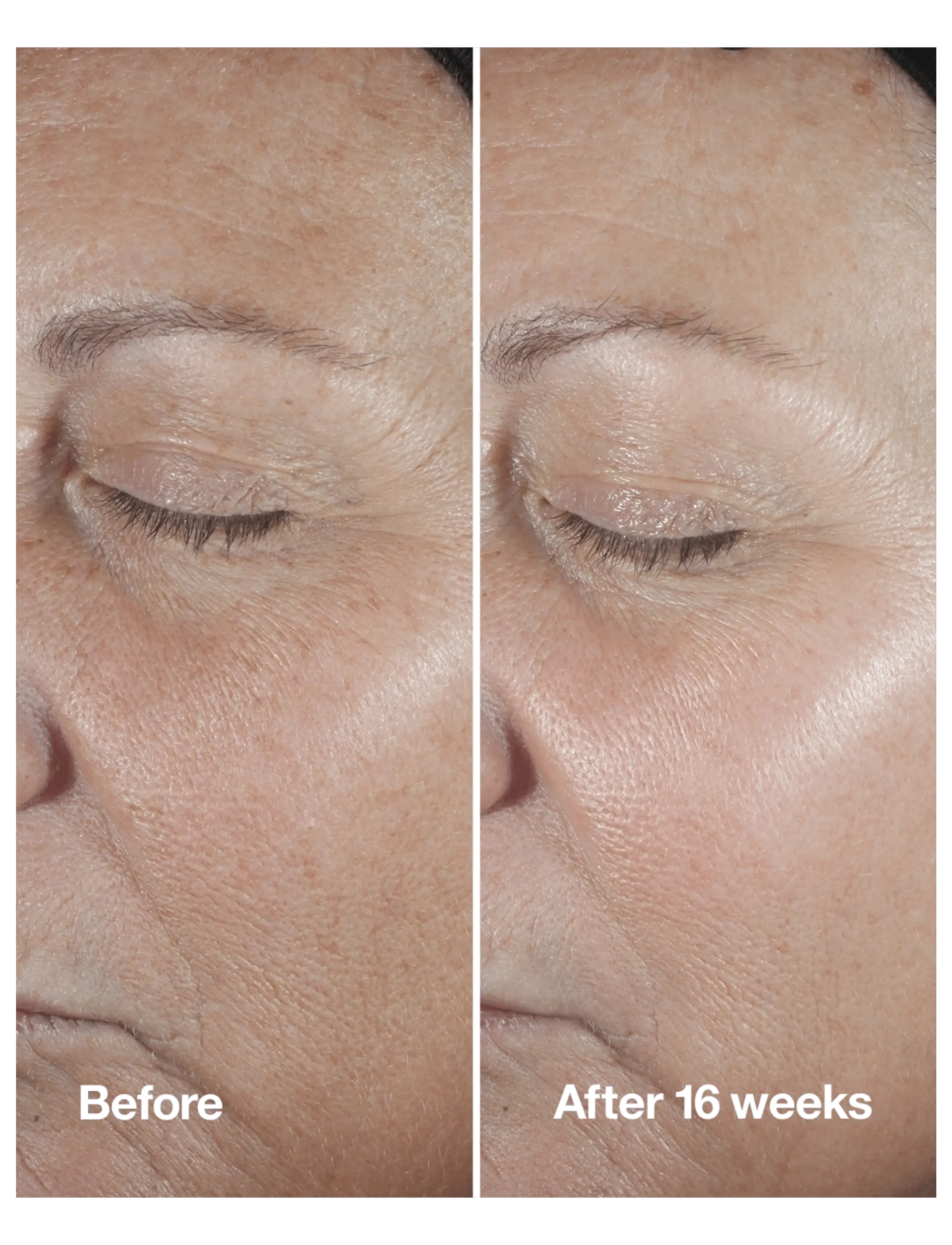 Clinique - Smart Clinical Repair Wrinkle Correcting Serum - serum & olier - clear - 3