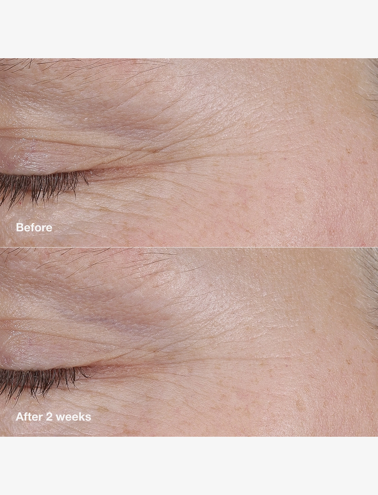 Clinique - Smart Clinical Repair AM/PM Retinoid Balm - sommerens hudpleje - no color - 4