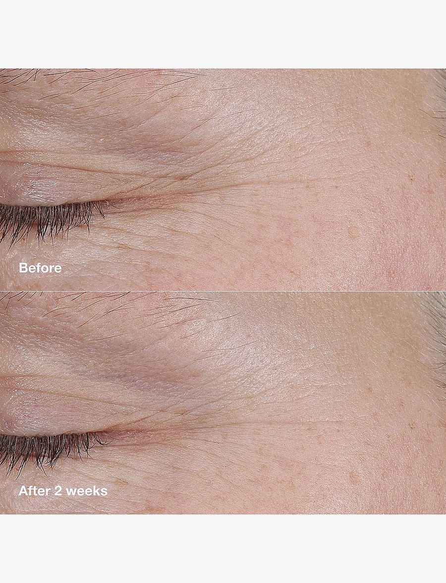 Clinique - Smart Clinical Repair AM/PM Retinoid Balm - sumarhúð - no color - 4