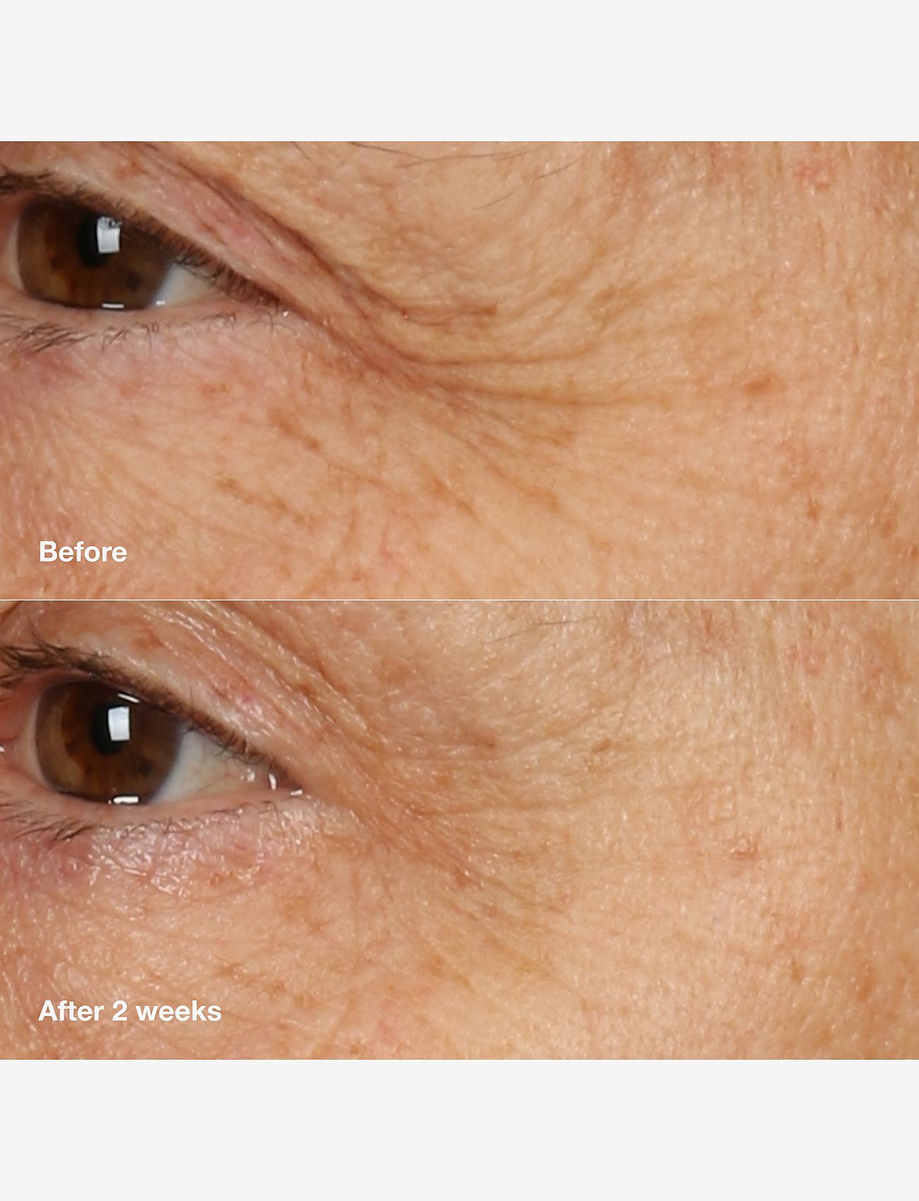 Clinique - Smart Clinical Repair Overnight Recovery Cream and Mask - sommerens hudpleje - multi - 3